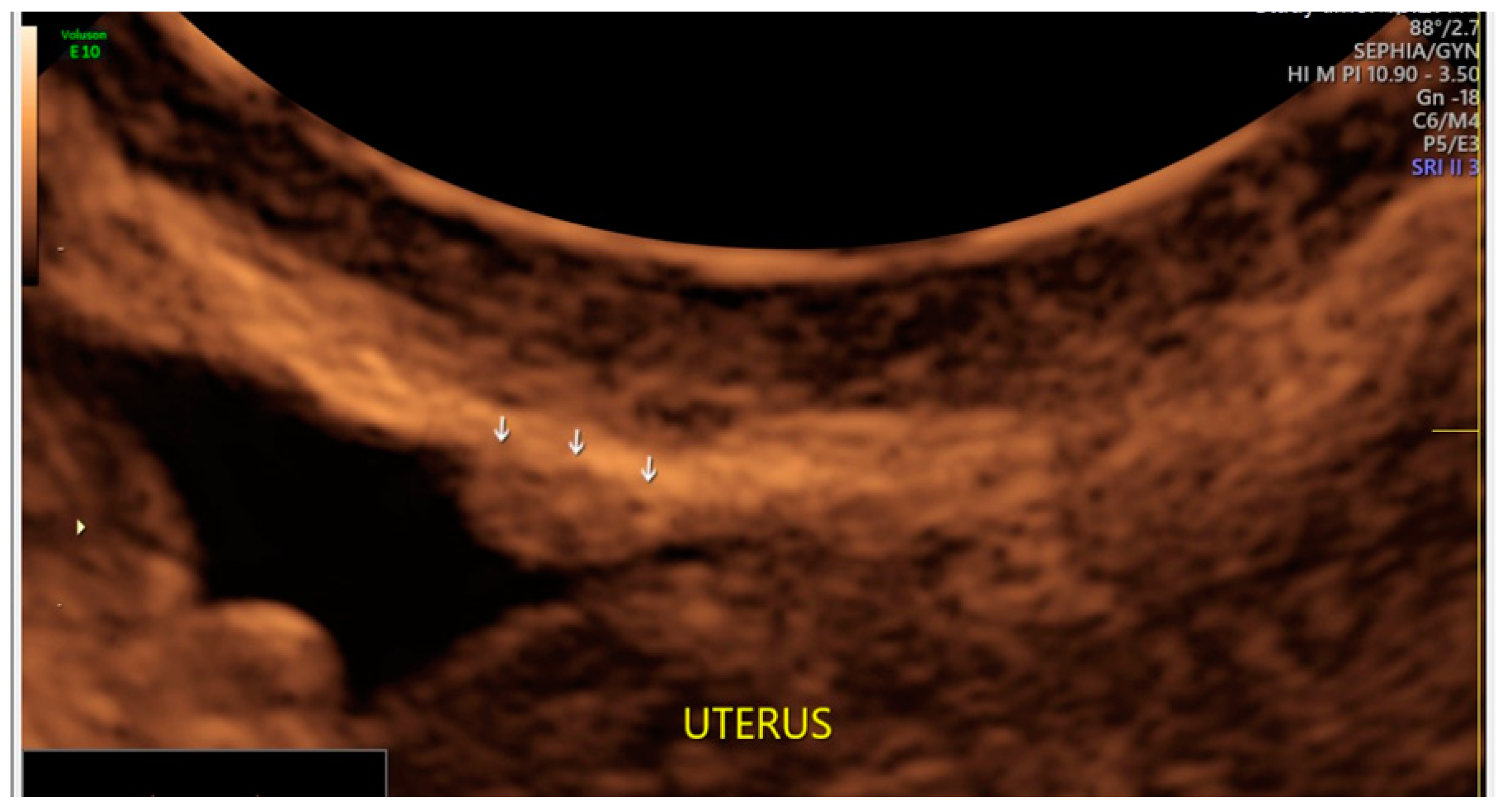 Diagnostics 13 01876 g025