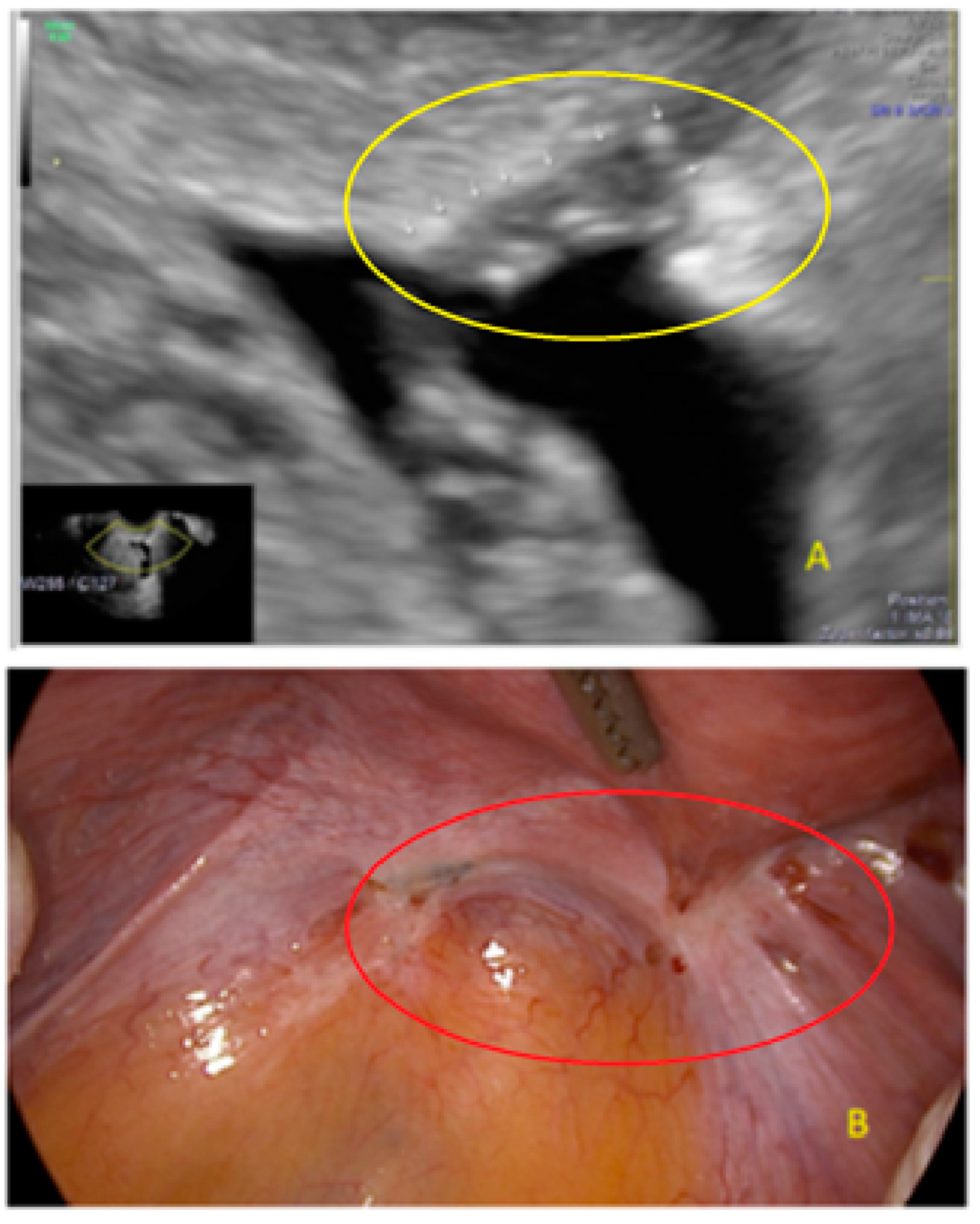 Diagnostics 13 01876 g026