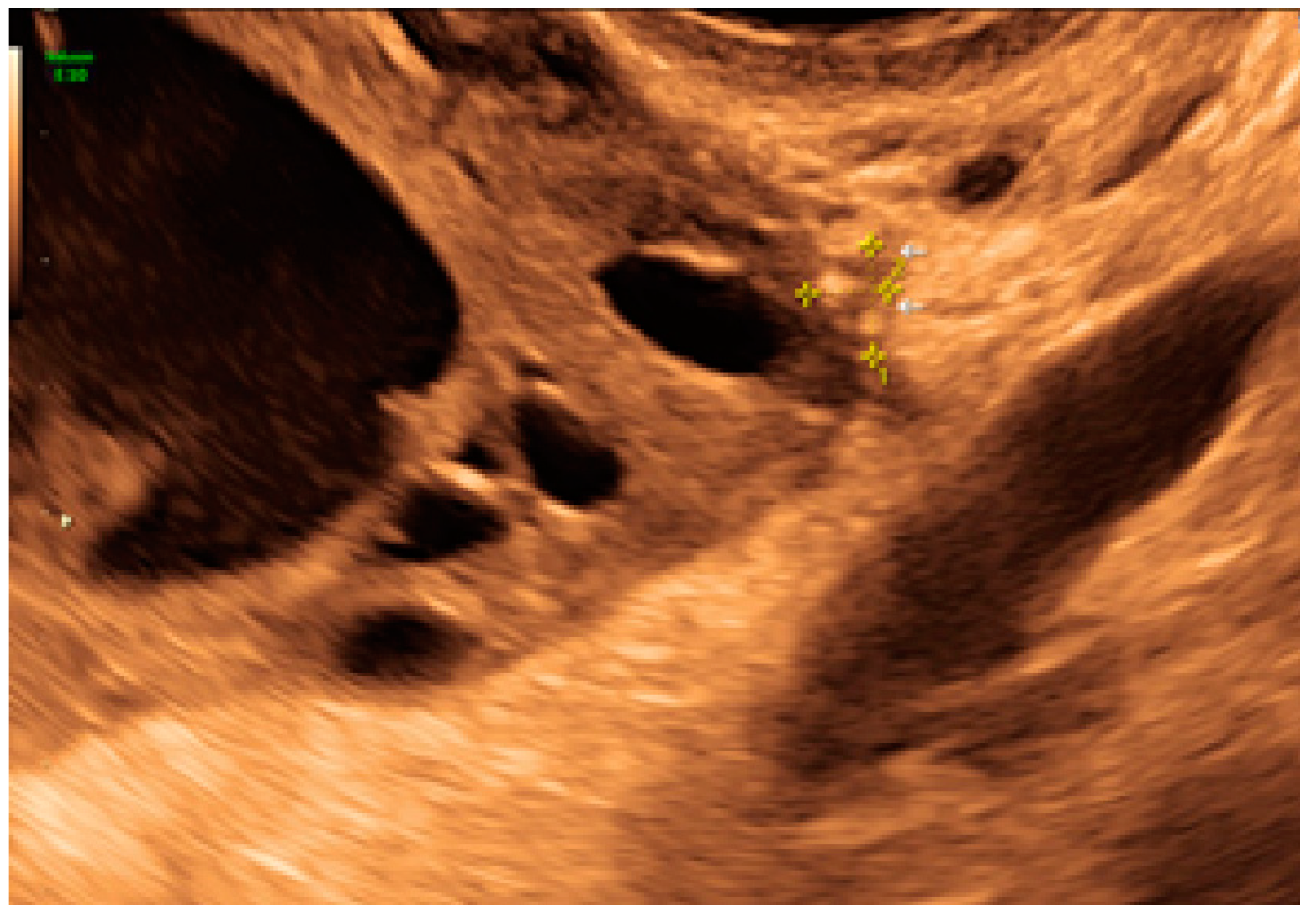 Diagnostics 13 01876 g027