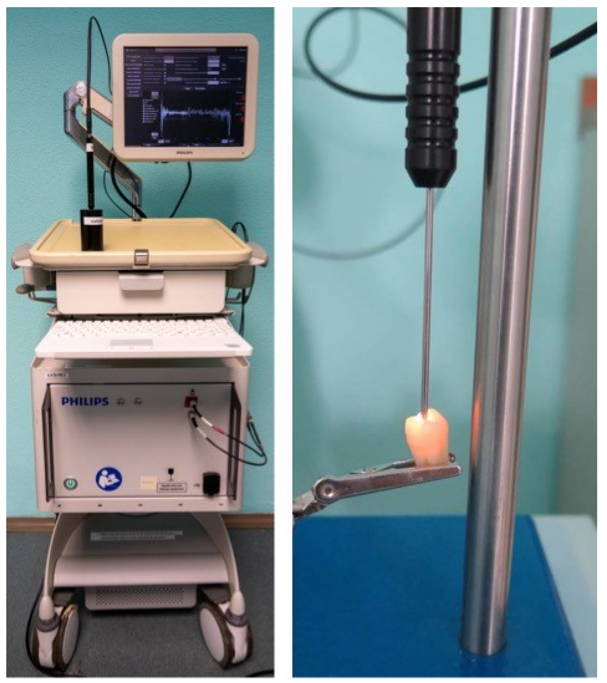 Diagnostics 13 01878 g001 Diagnostics 13 01878 g001