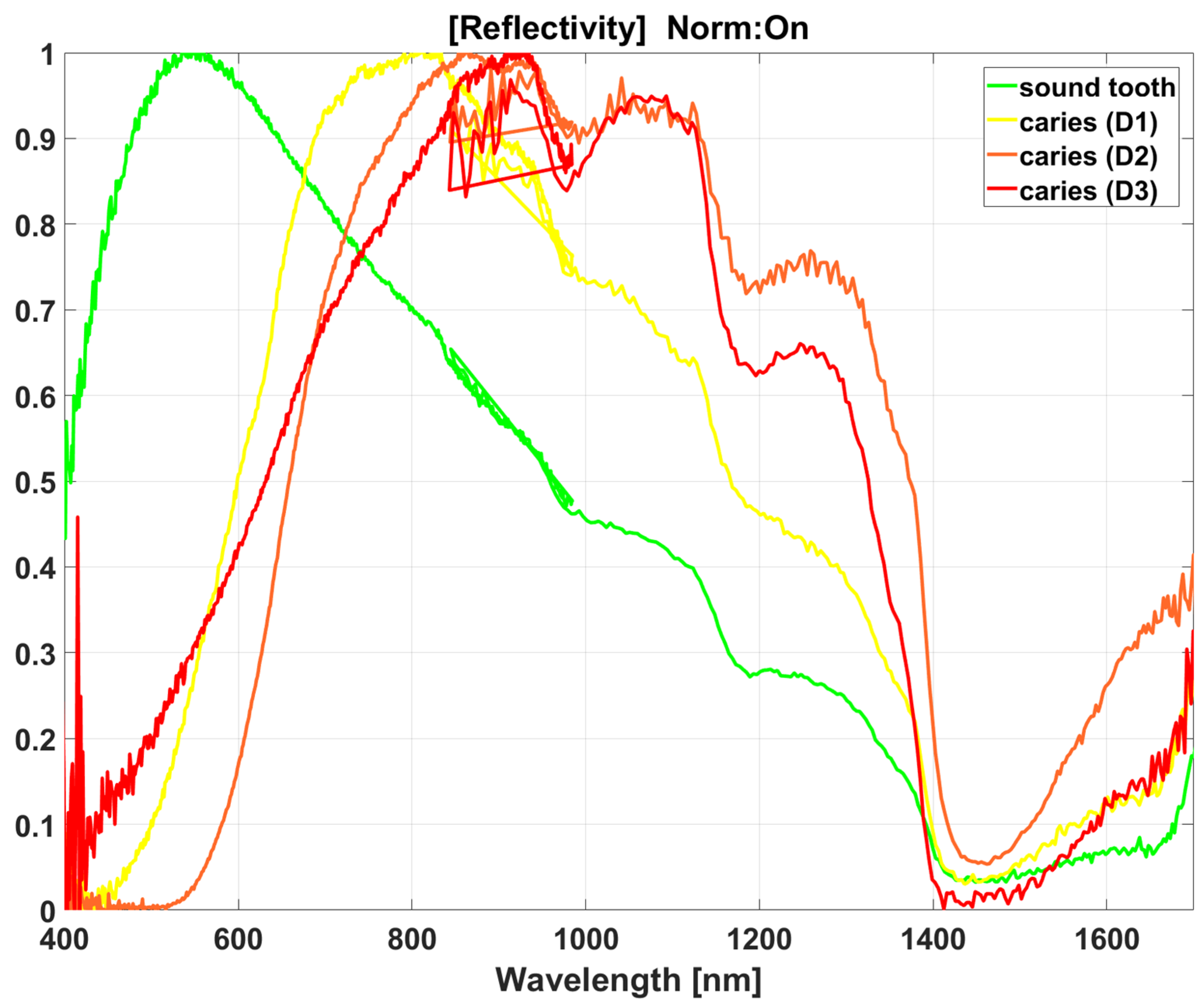 Diagnostics 13 01878 g002 Diagnostics 13 01878 g002