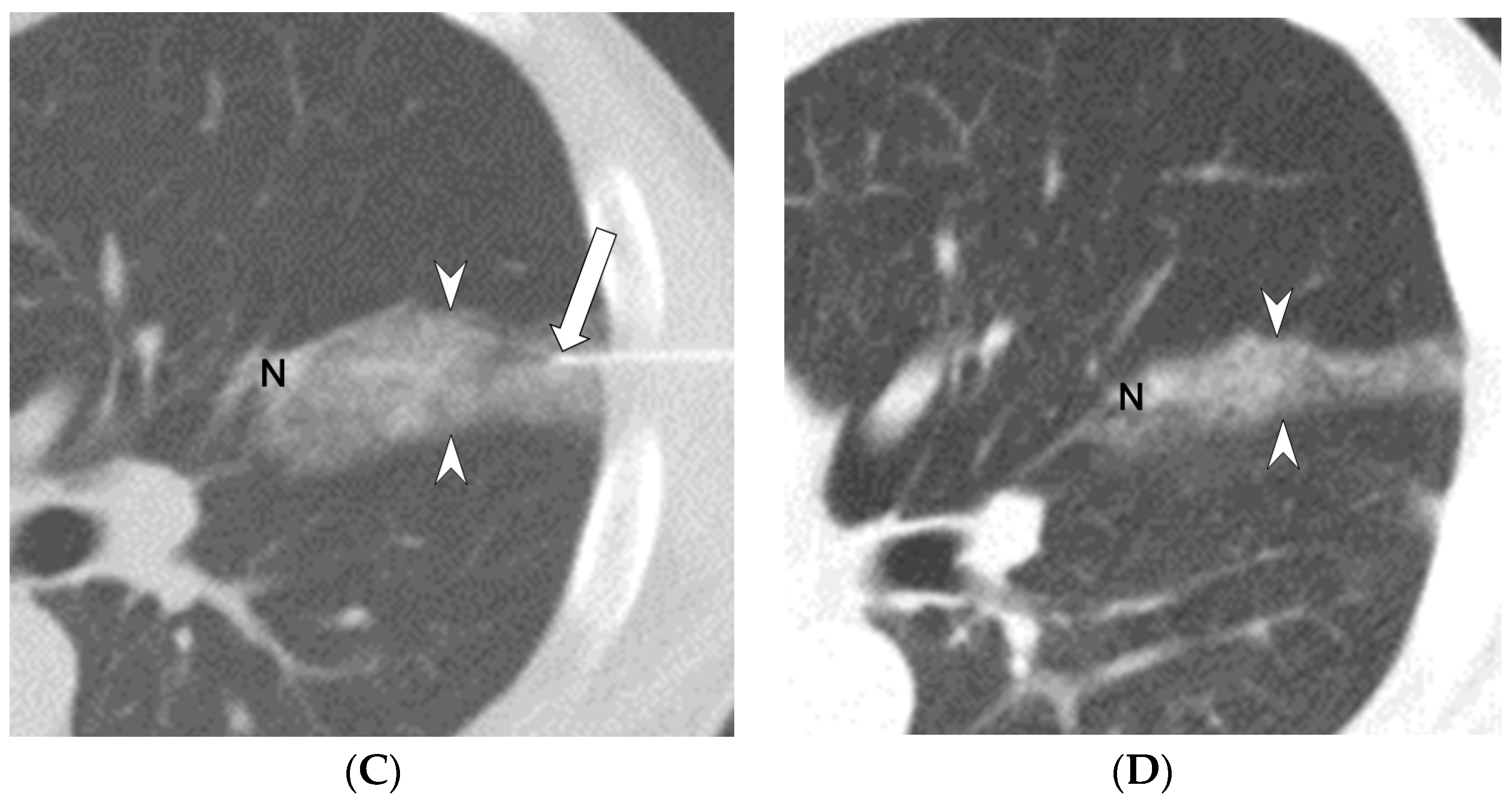 Diagnostics 13 01881 g003b