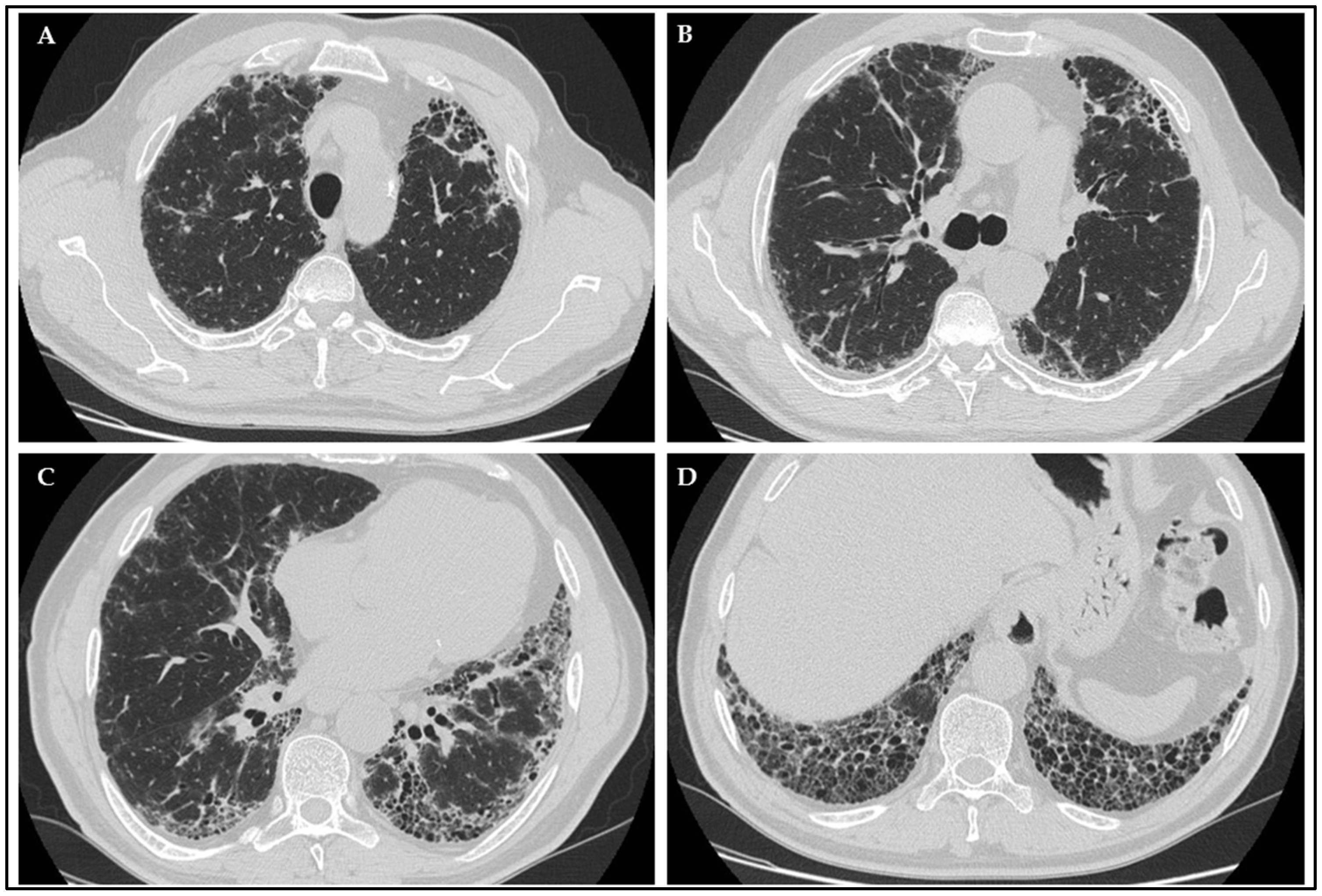 Diagnostics 13 01882 g002