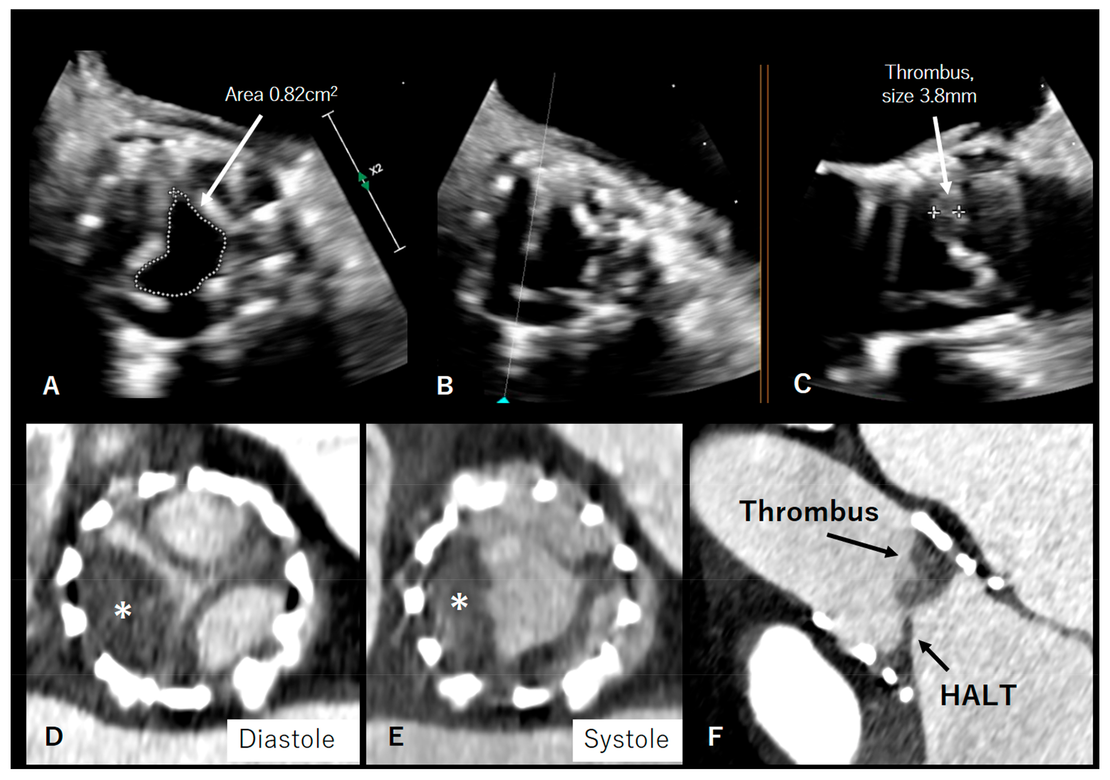 Diagnostics 13 01908 g004