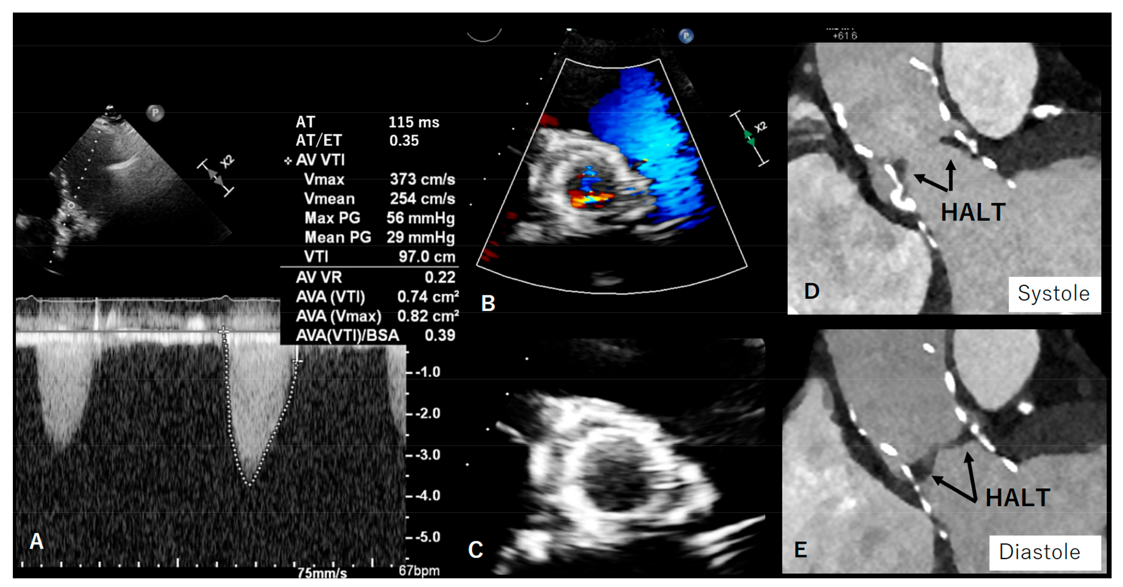 Diagnostics 13 01908 g005