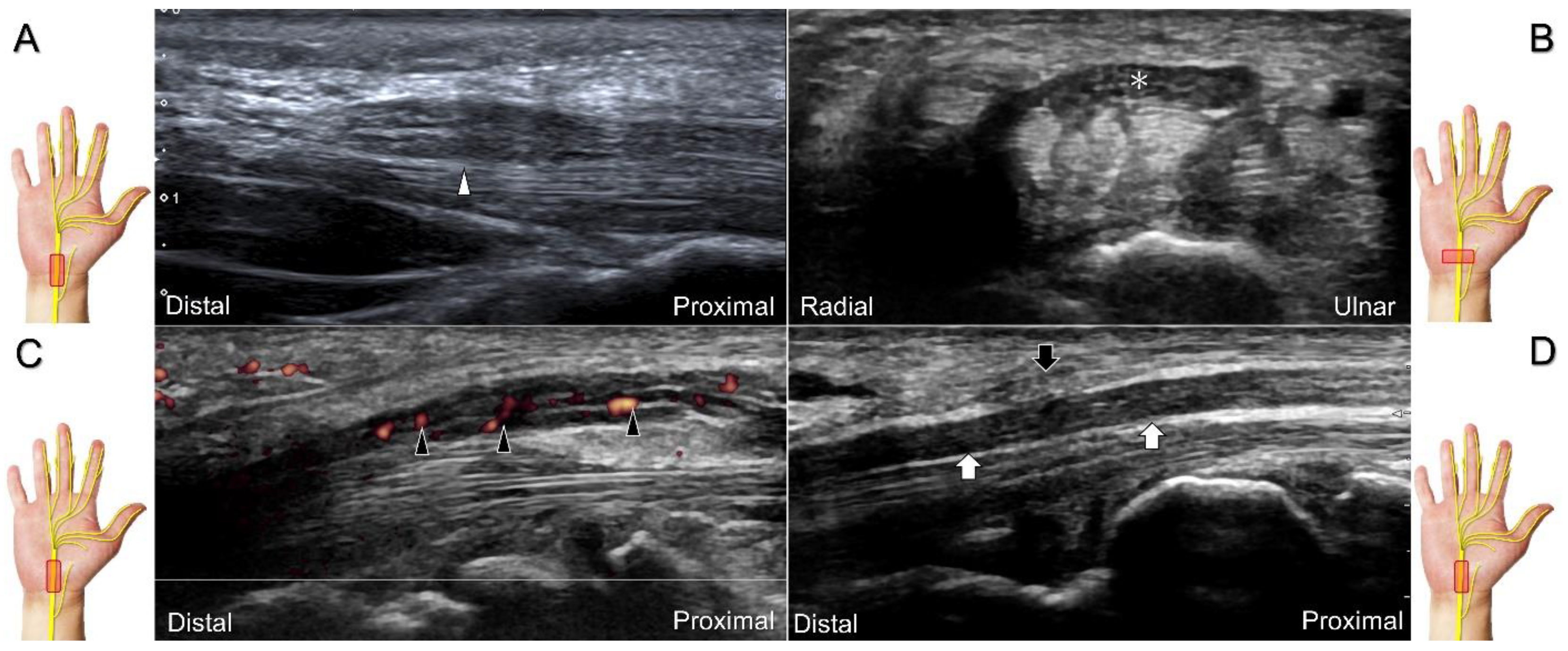 Diagnostics 13 01928 g003