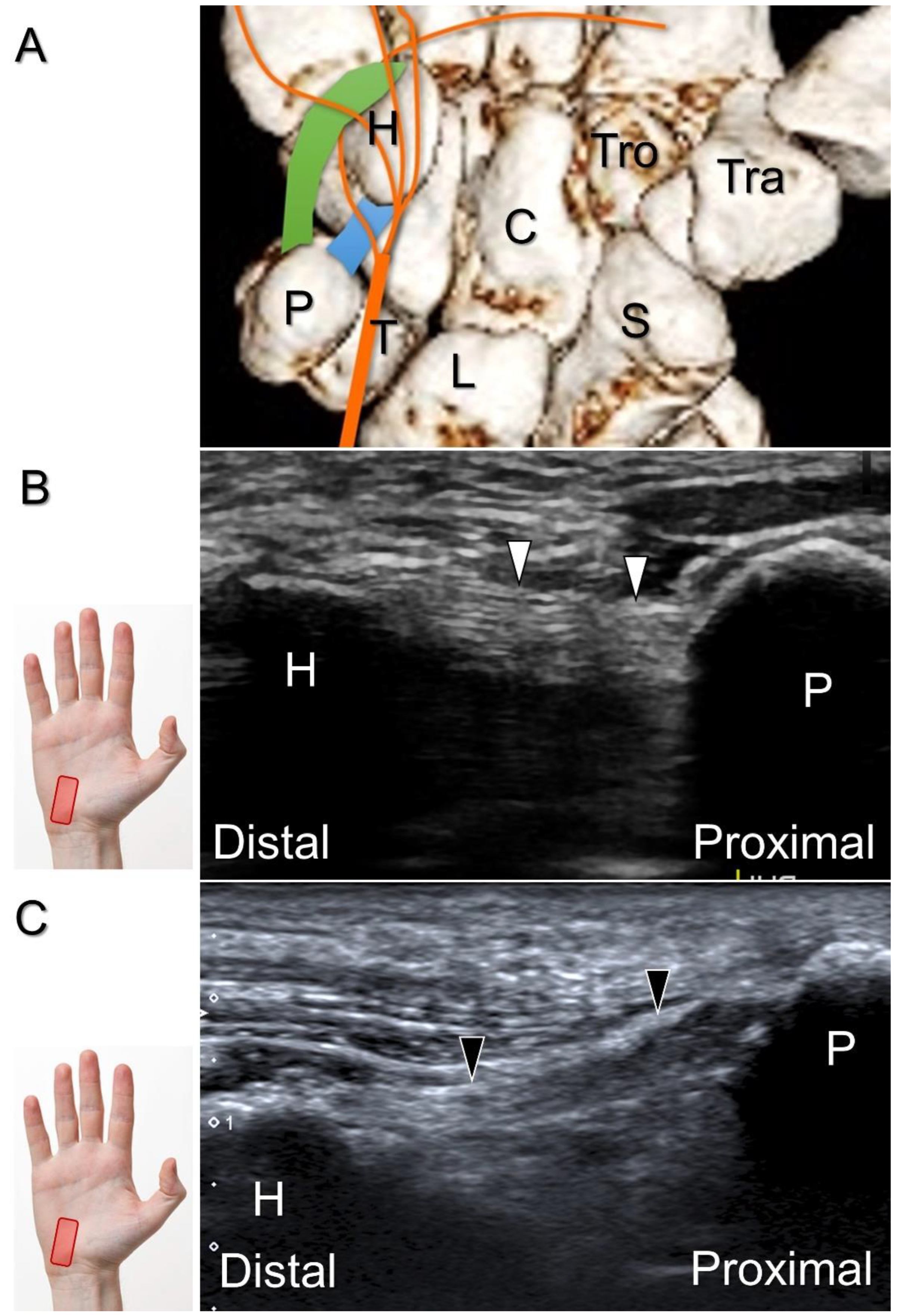 Diagnostics 13 01928 g015
