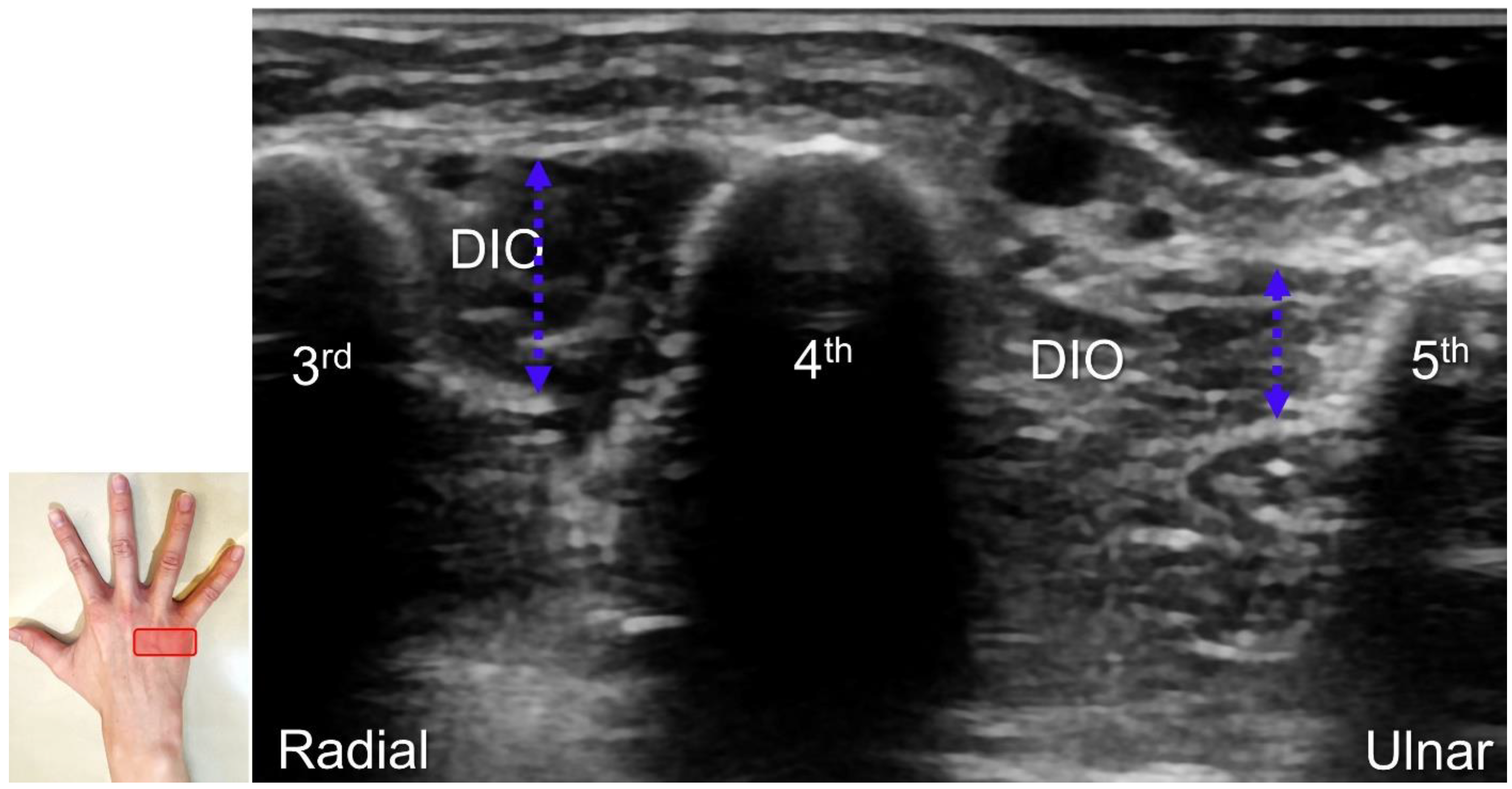 Diagnostics 13 01928 g016