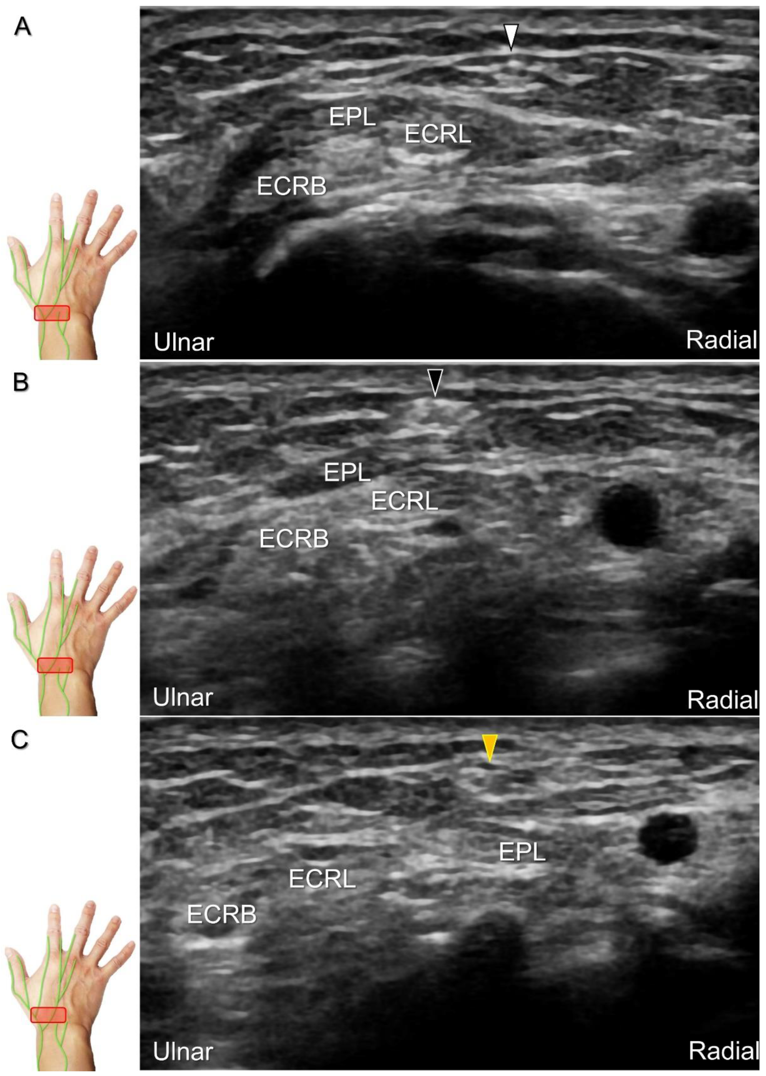 Diagnostics 13 01928 g022