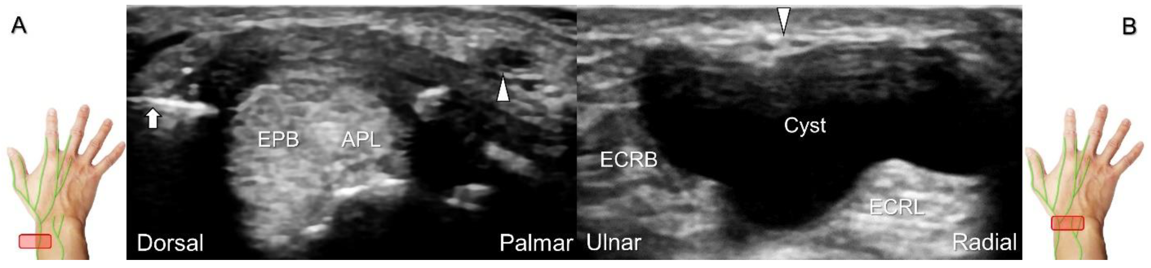 Diagnostics 13 01928 g023
