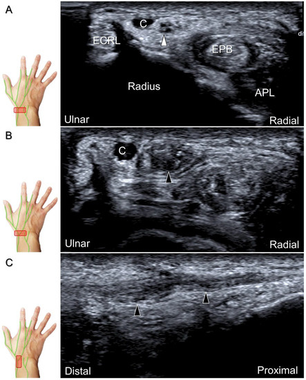 Diagnostics 13 01928 g025