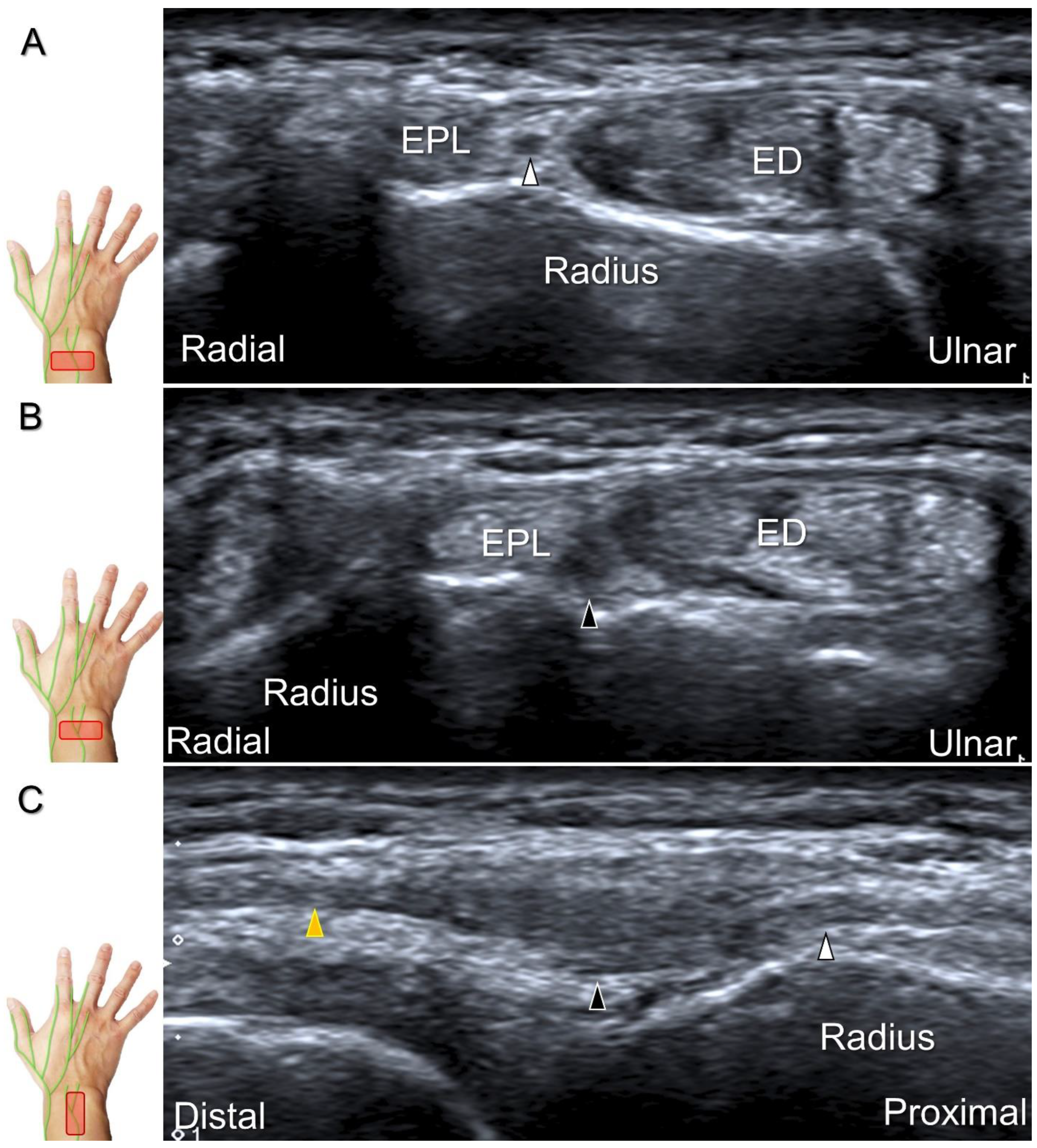 Diagnostics 13 01928 g026