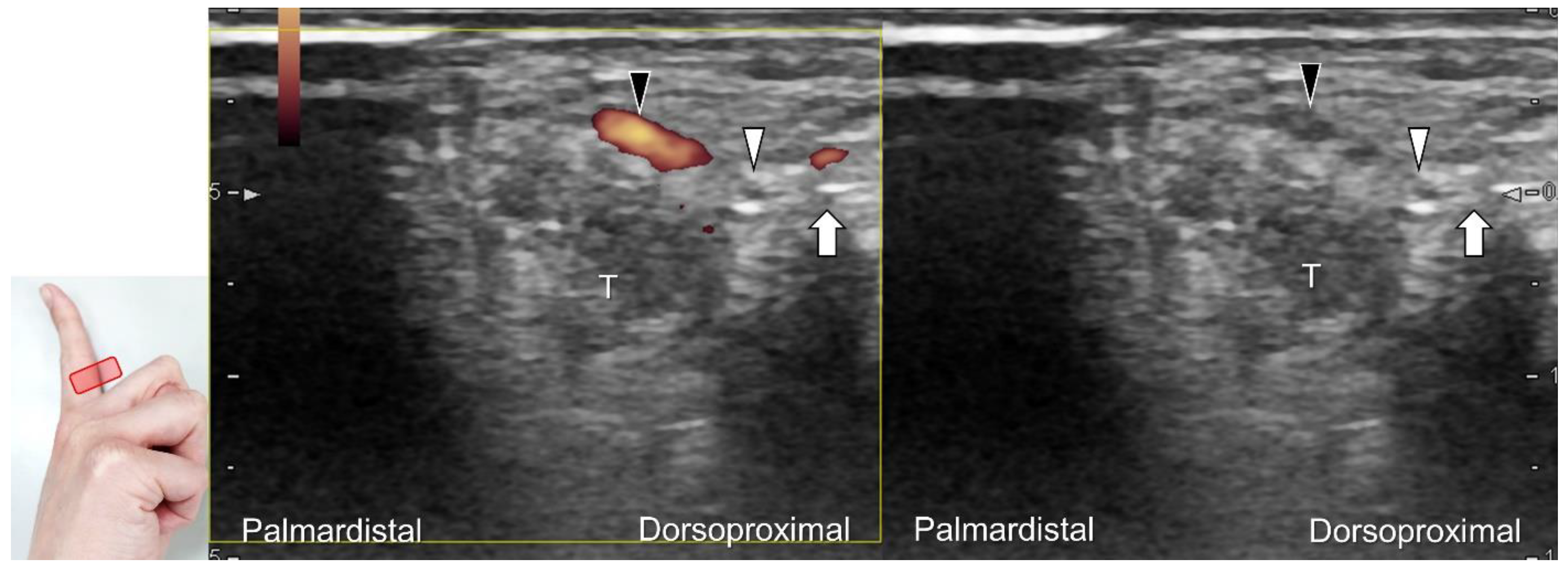 Diagnostics 13 01928 g037