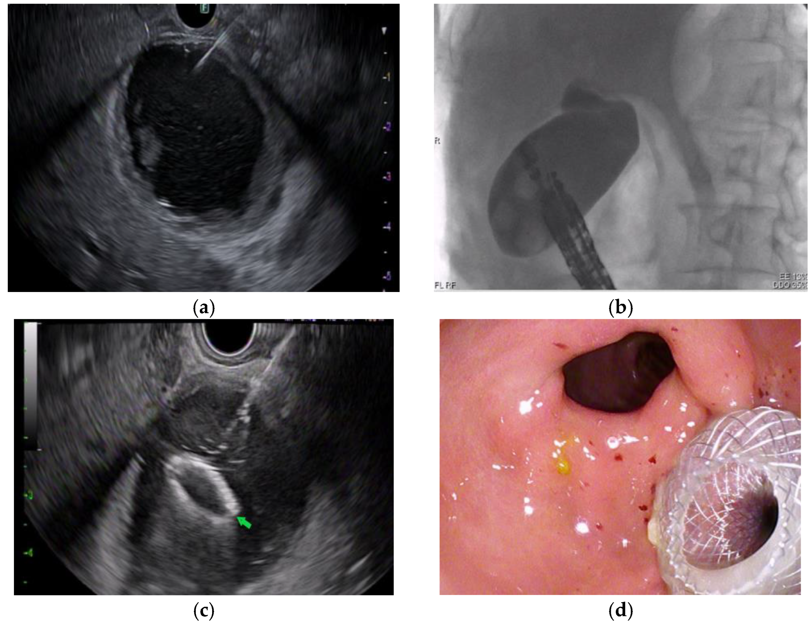 Diagnostics 13 01933 g002