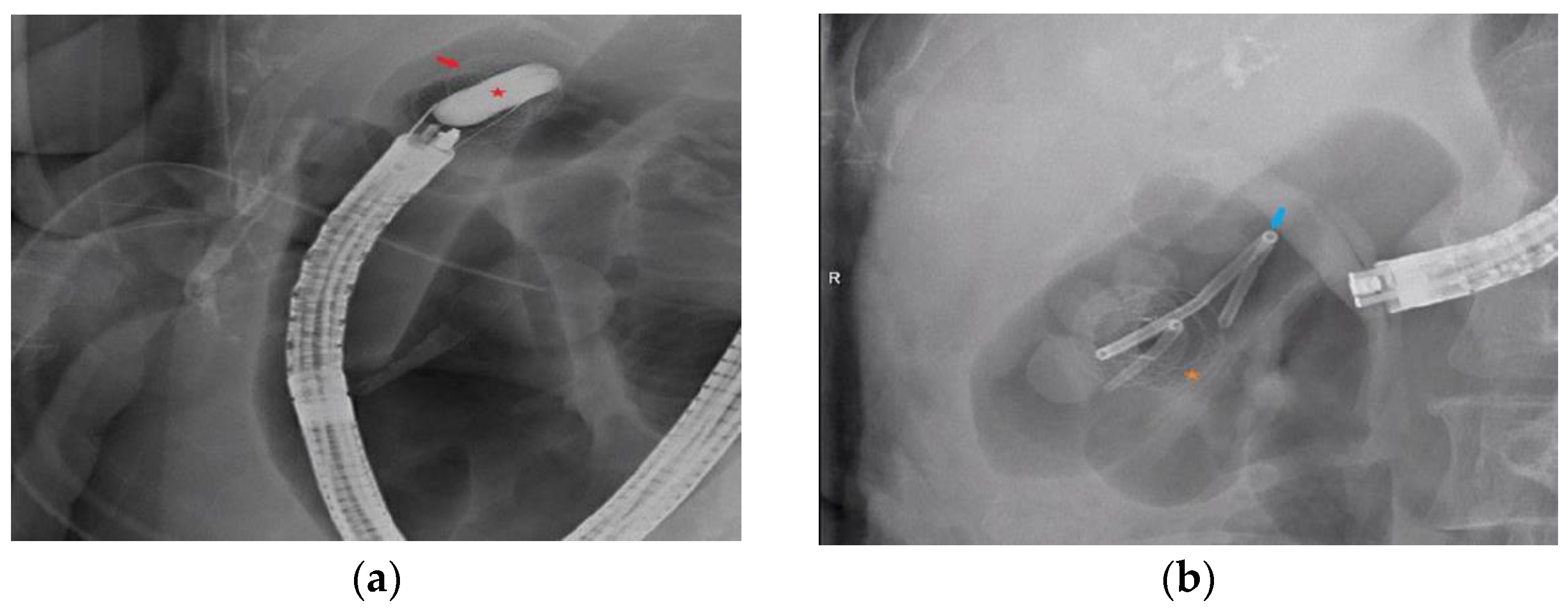 Diagnostics 13 01933 g003