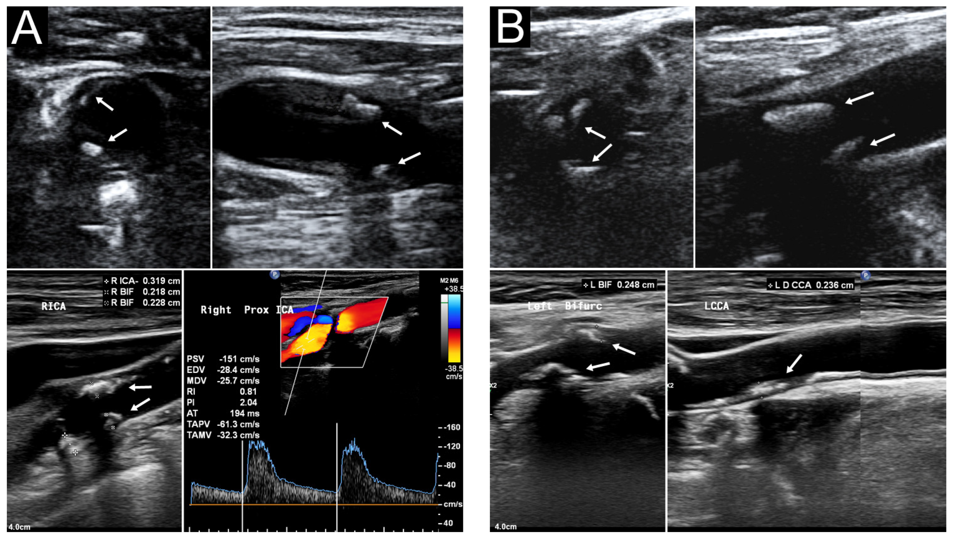 Diagnostics 13 01952 g003 Diagnostics 13 01952 g003