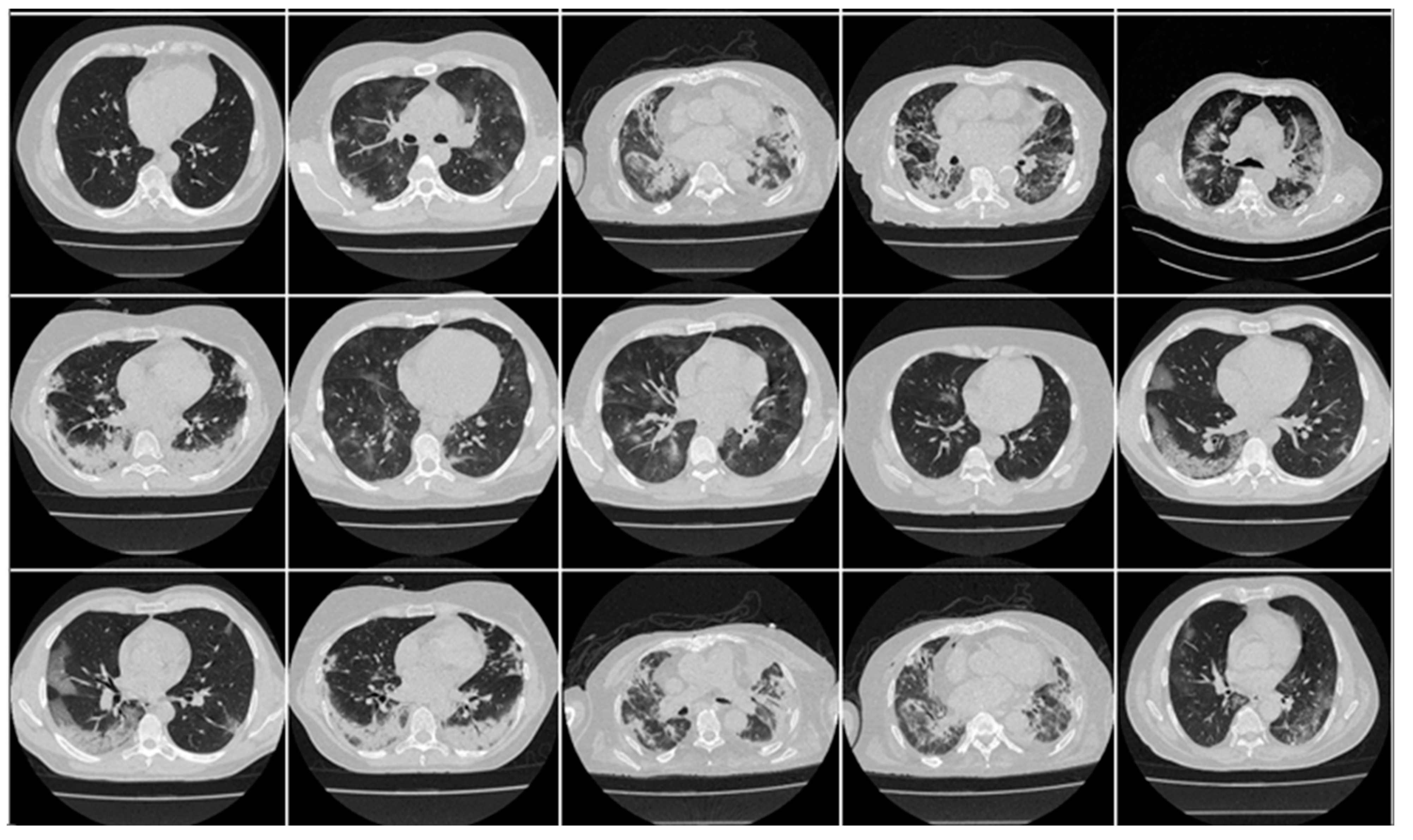Diagnostics 13 01954 g001