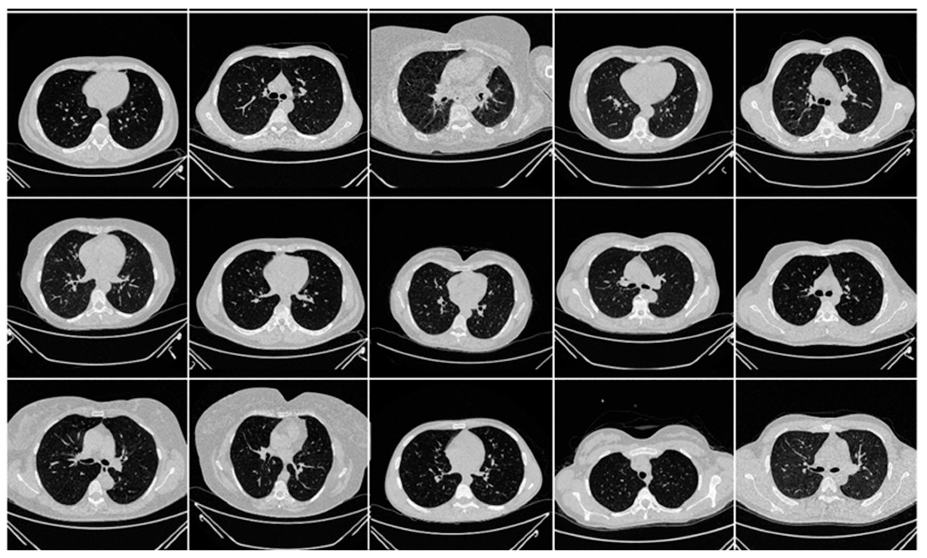 Diagnostics 13 01954 g003