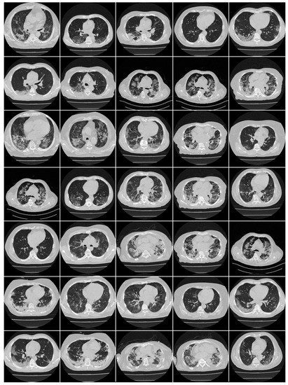 Diagnostics 13 01954 g0a1