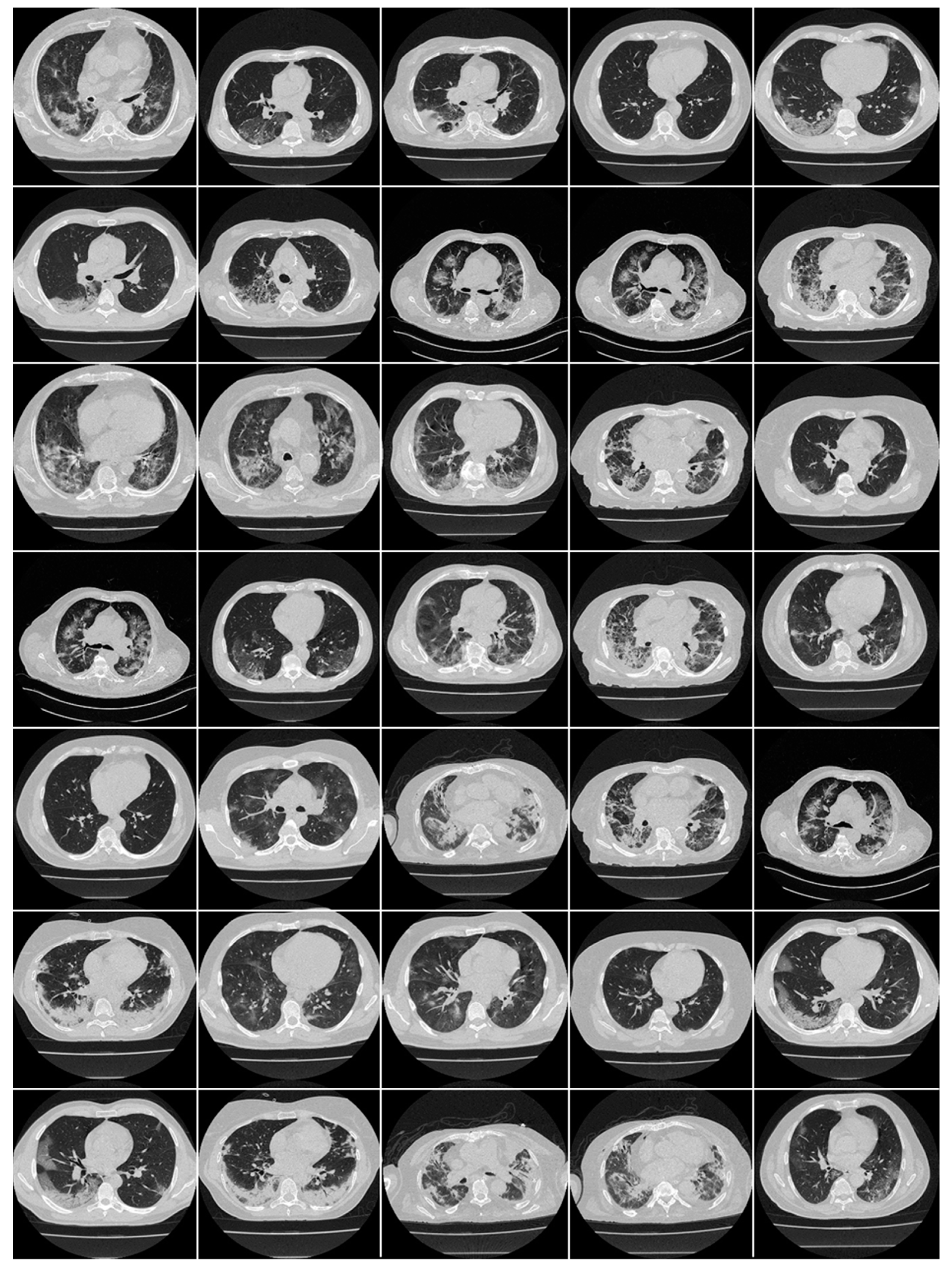 Diagnostics 13 01954 g0a1