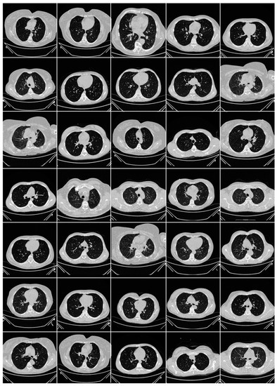 Diagnostics 13 01954 g0a2