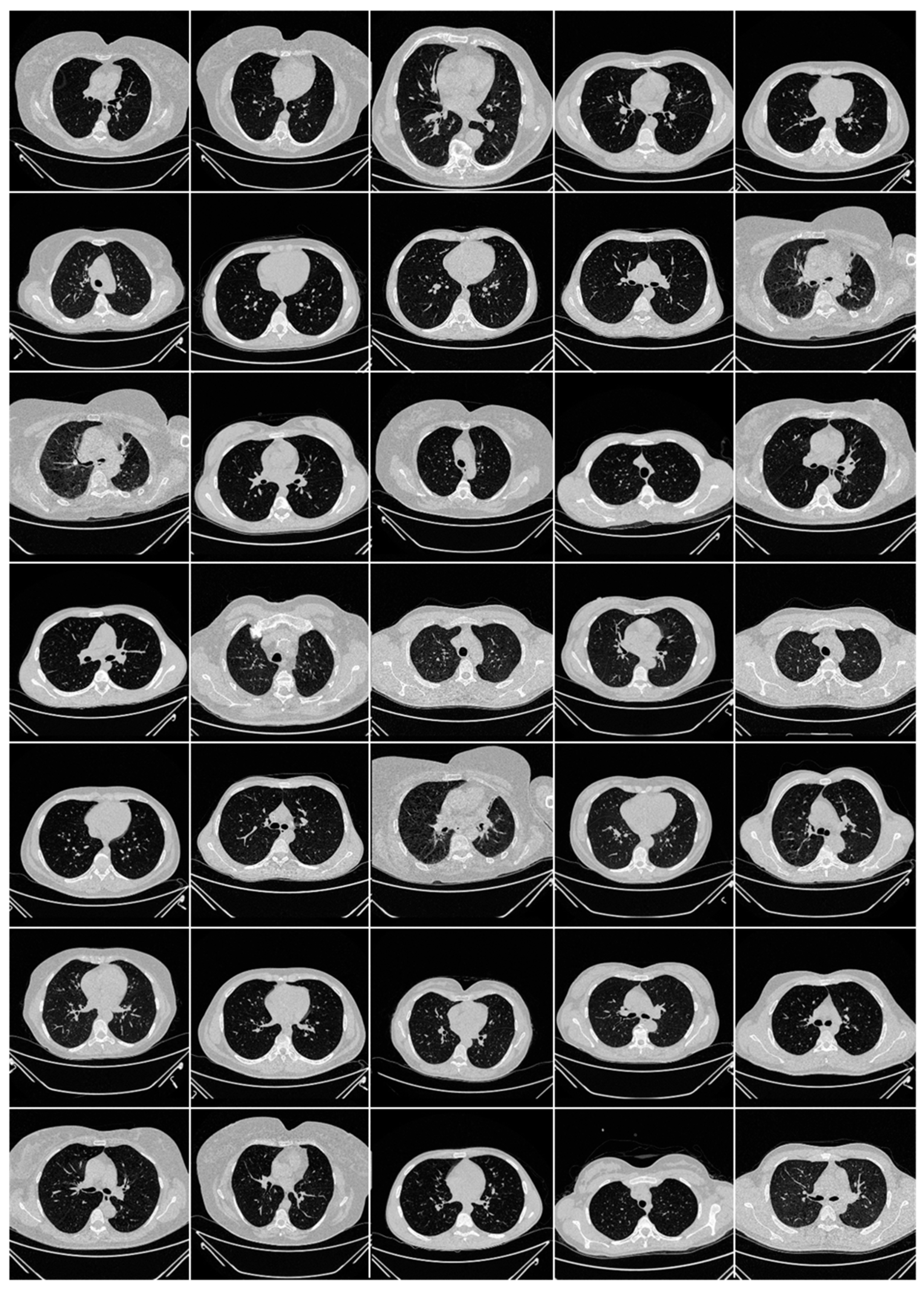 Diagnostics 13 01954 g0a2