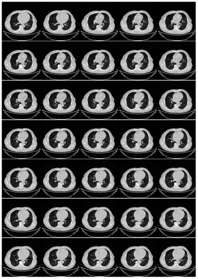 Diagnostics 13 01954 g0a3