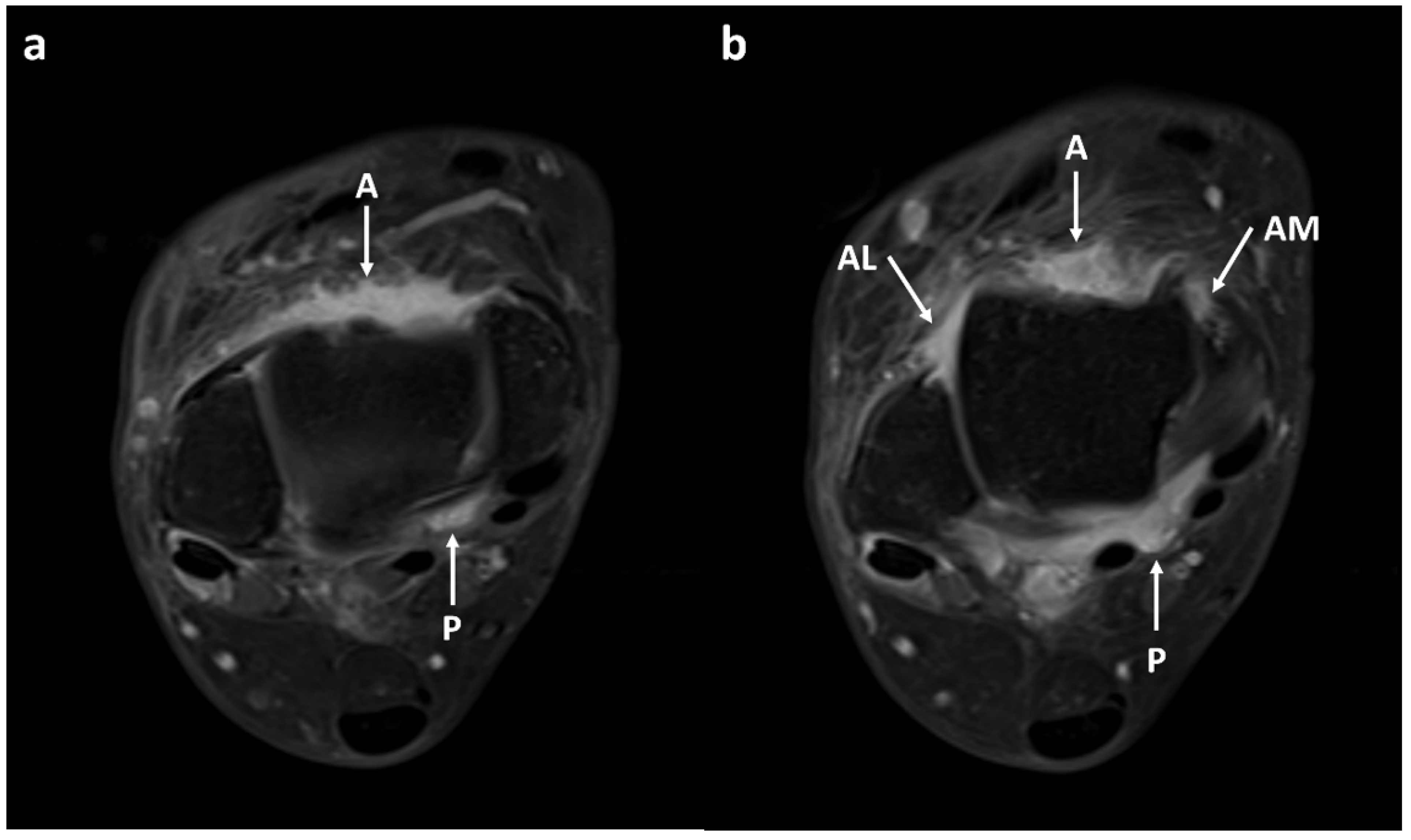 Diagnostics 13 01960 g002