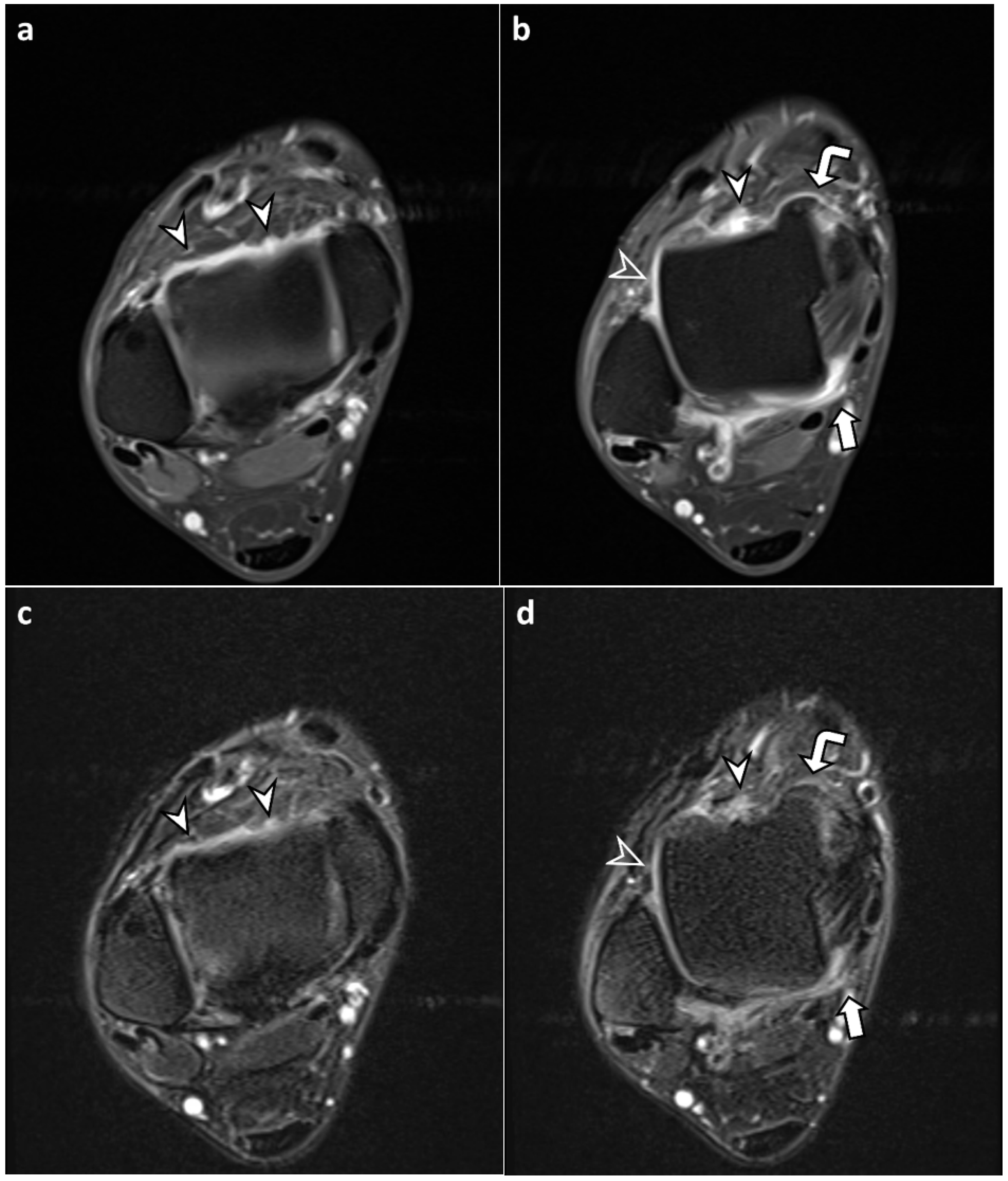 Diagnostics 13 01960 g003