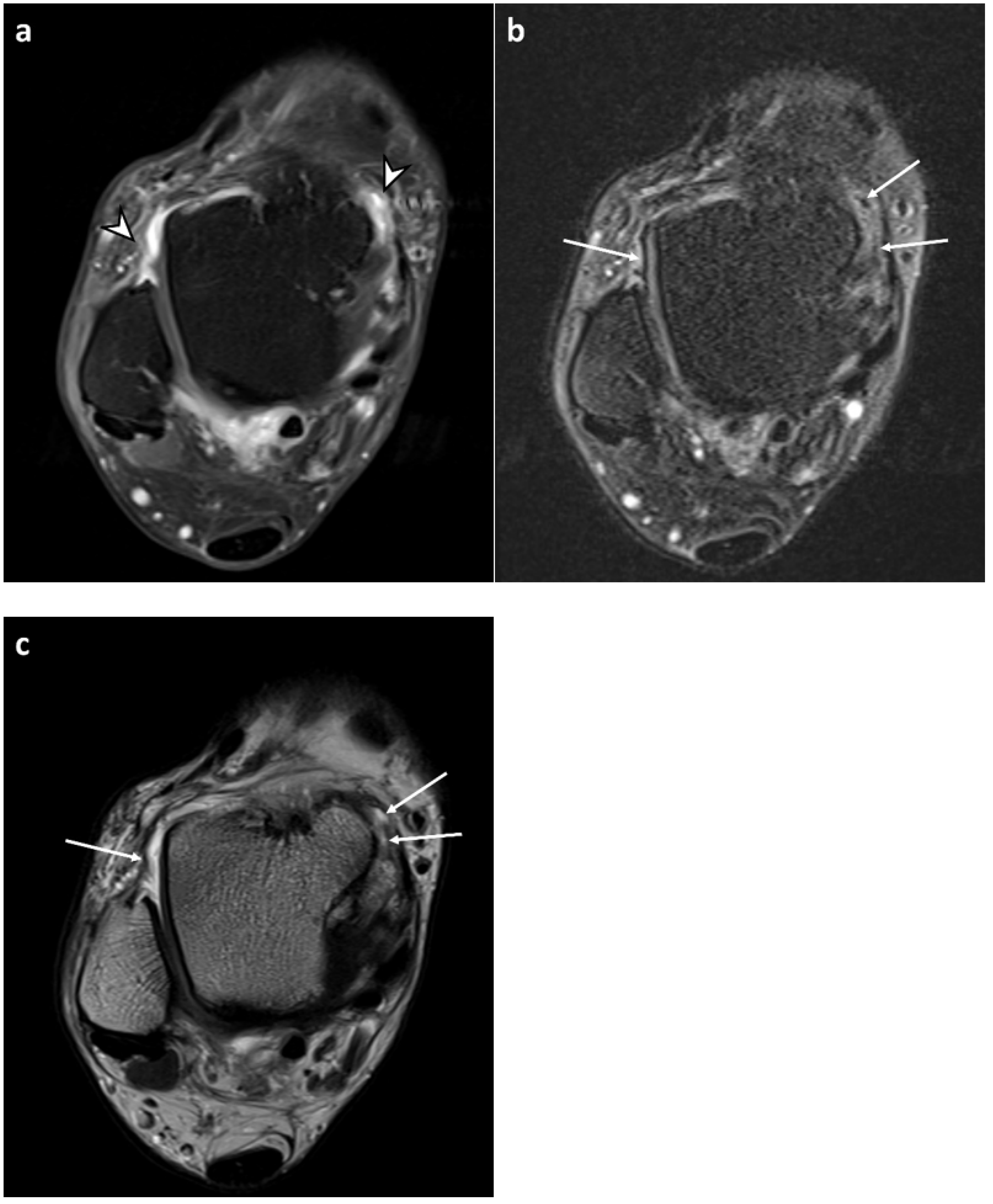 Diagnostics 13 01960 g004