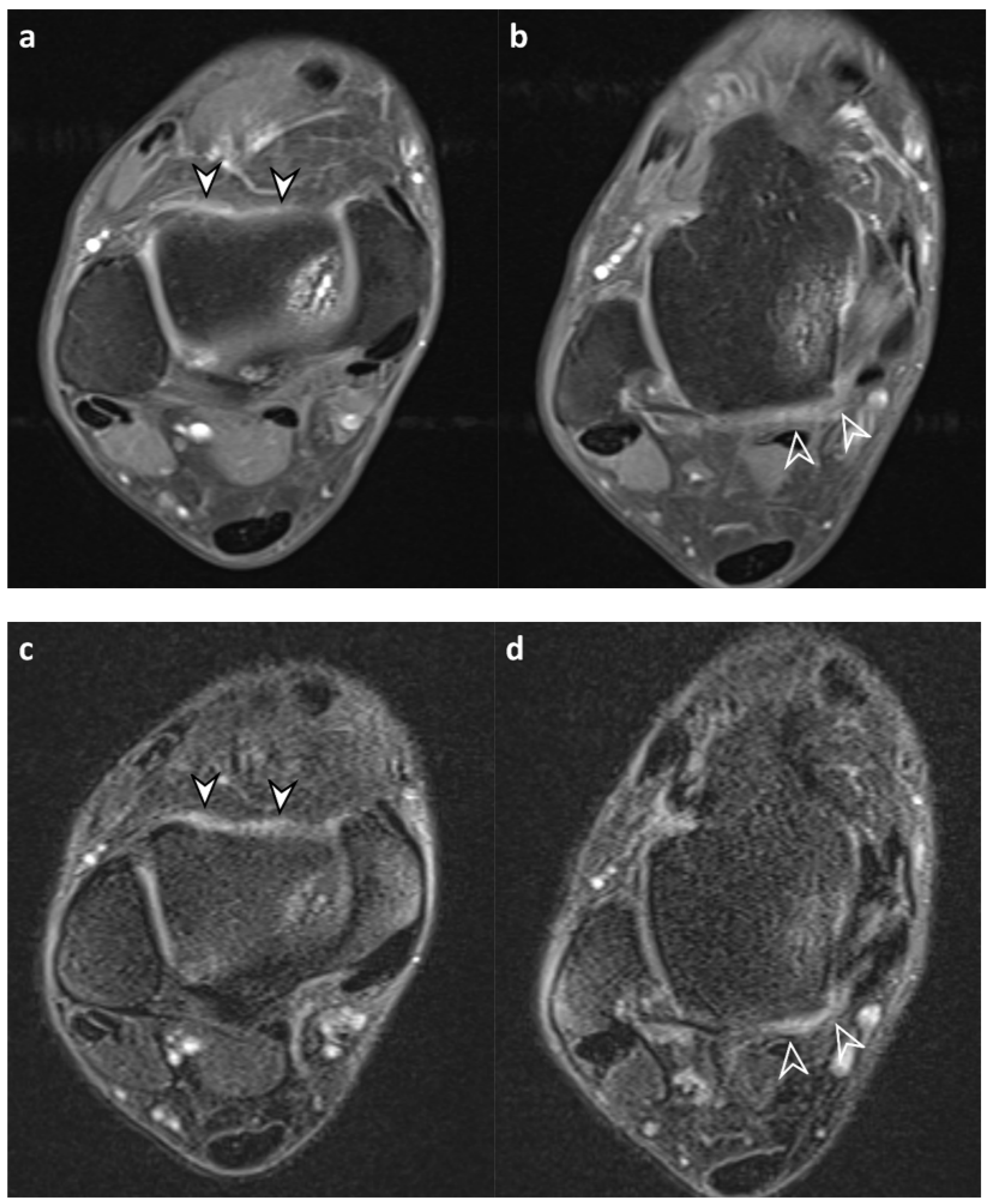 Diagnostics 13 01960 g005