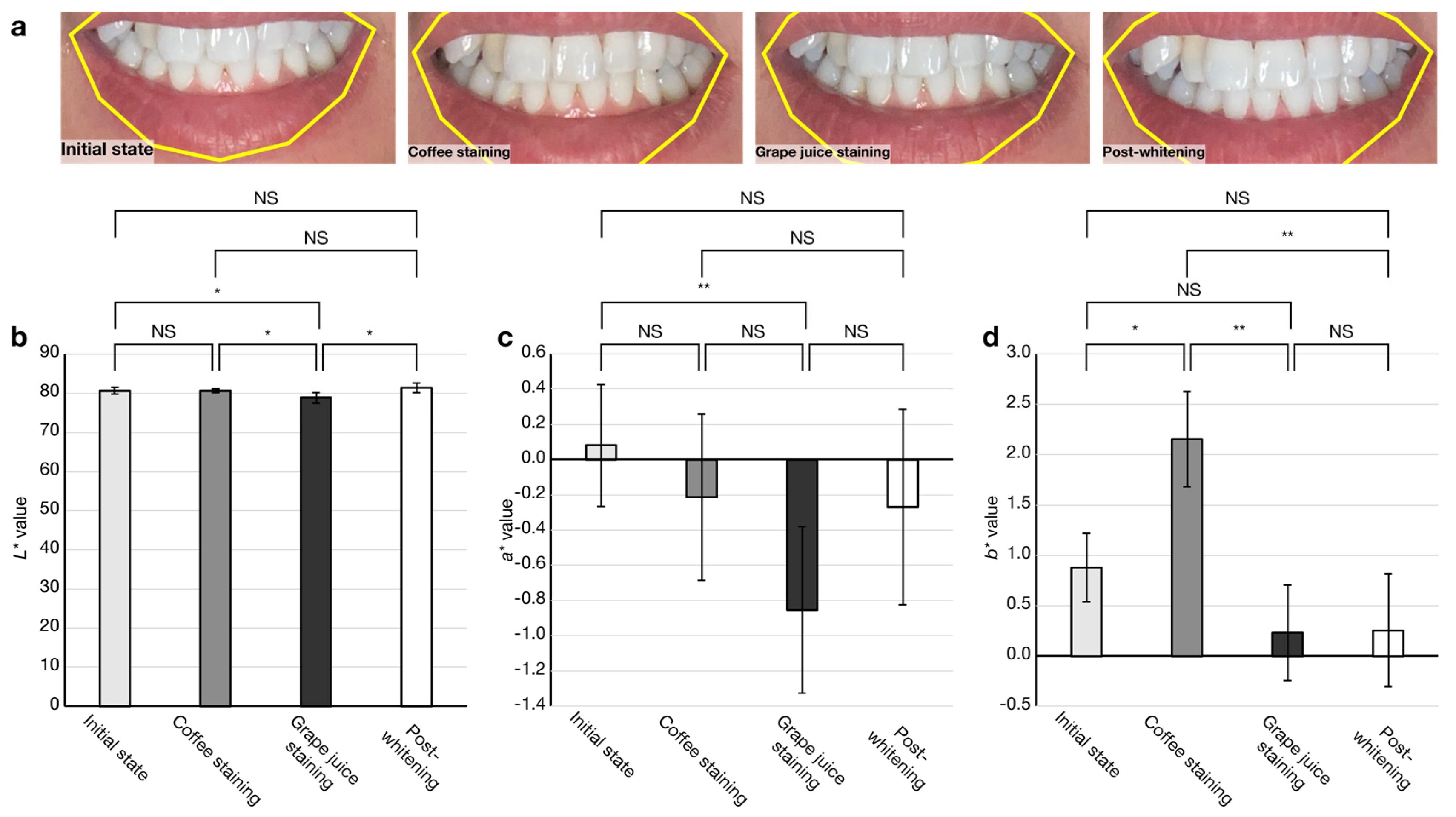 Diagnostics 13 01969 g005