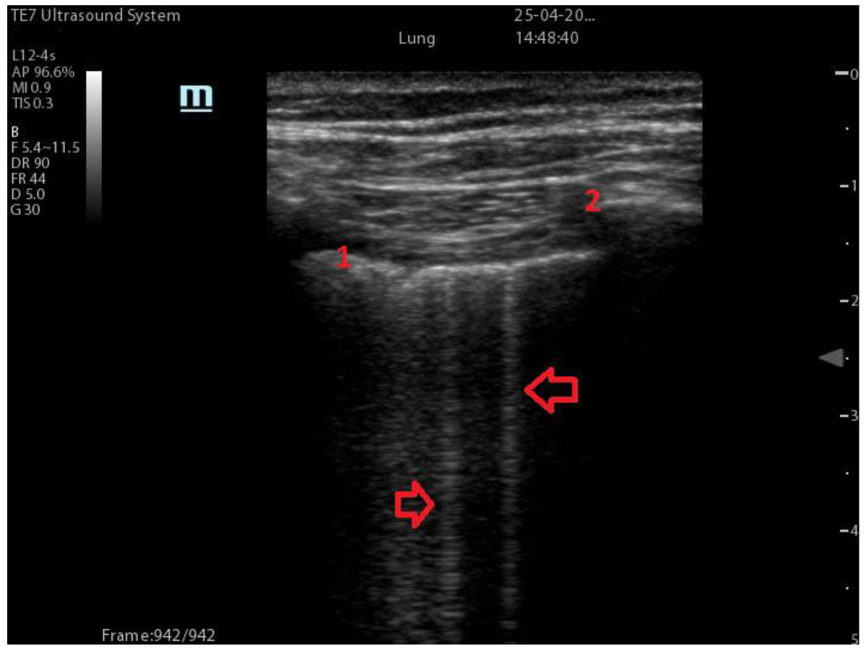 Diagnostics 13 01972 g001