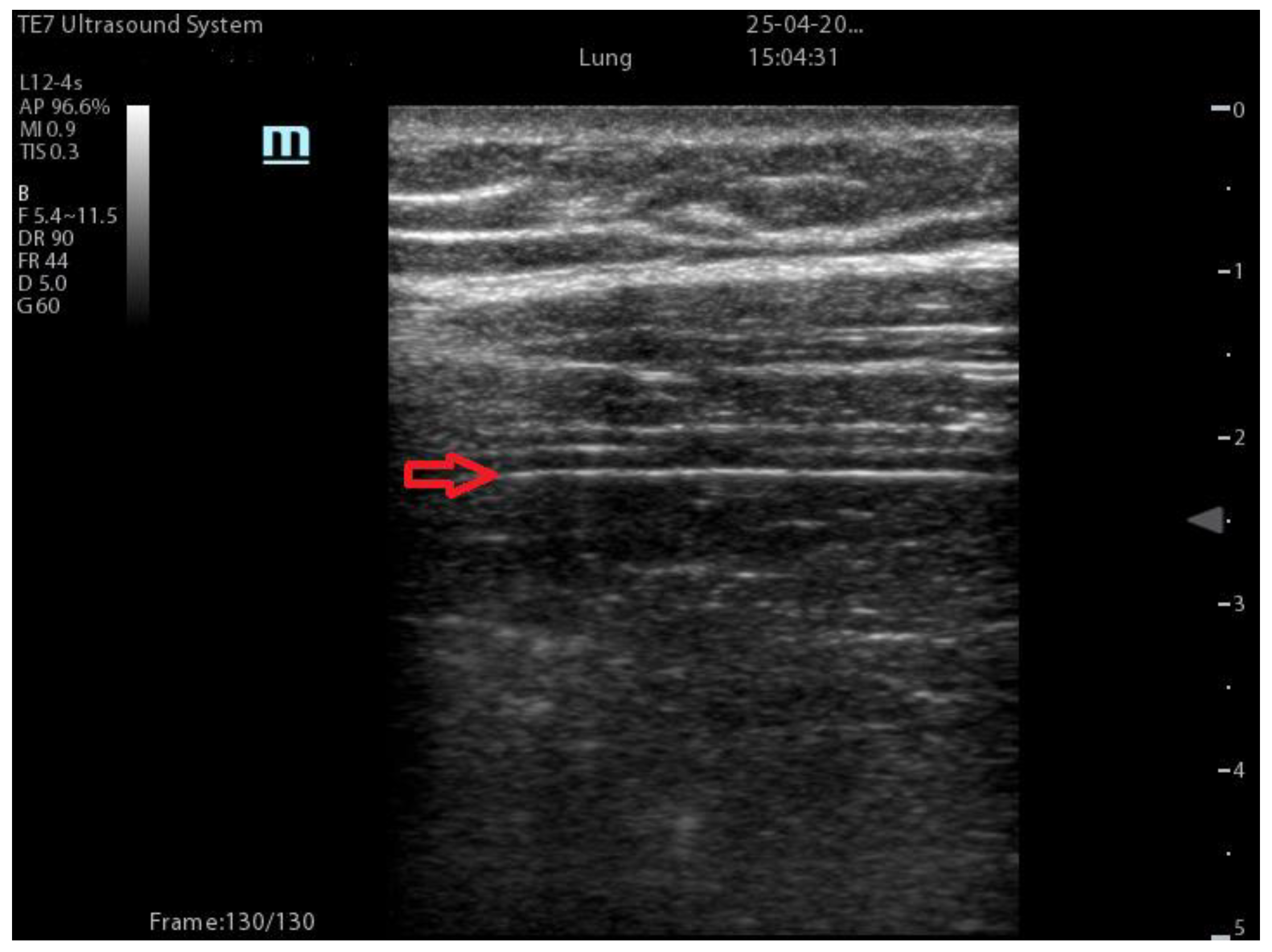 Diagnostics 13 01972 g003