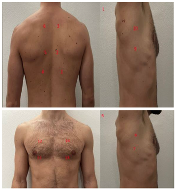 Diagnostics 13 01972 i003