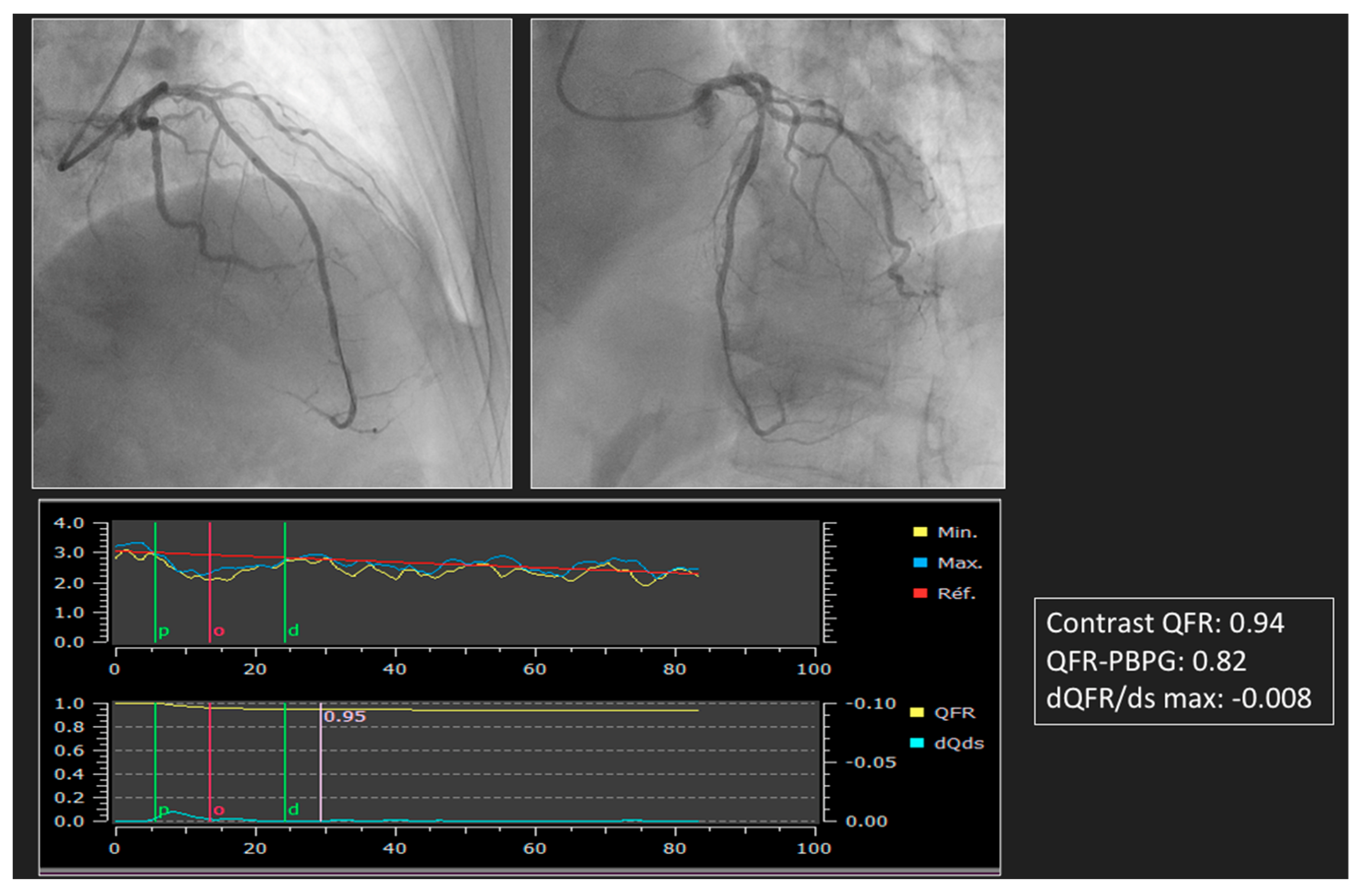 Diagnostics 13 01978 g003 Diagnostics 13 01978 g003