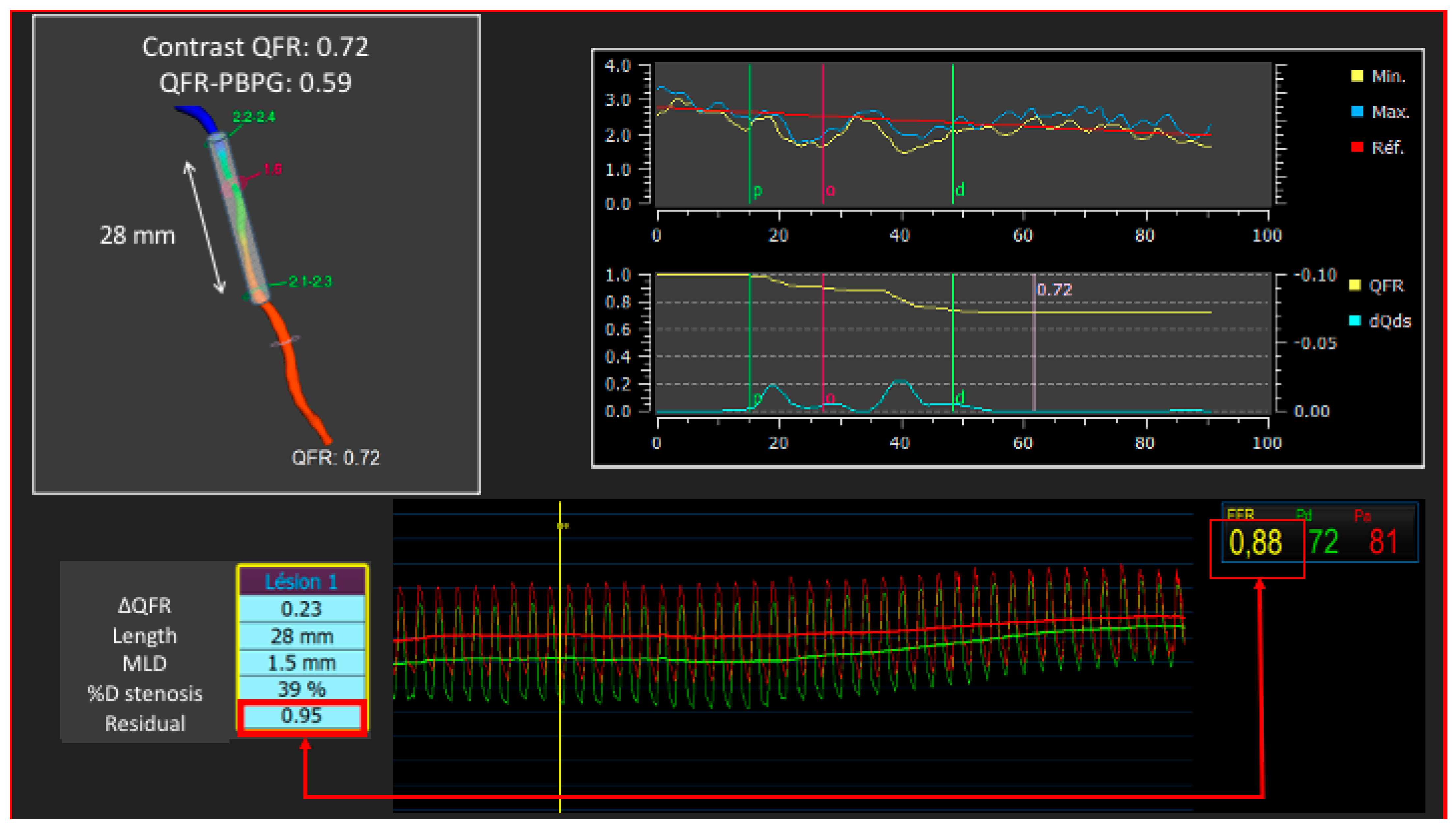 Diagnostics 13 01978 g004 Diagnostics 13 01978 g004
