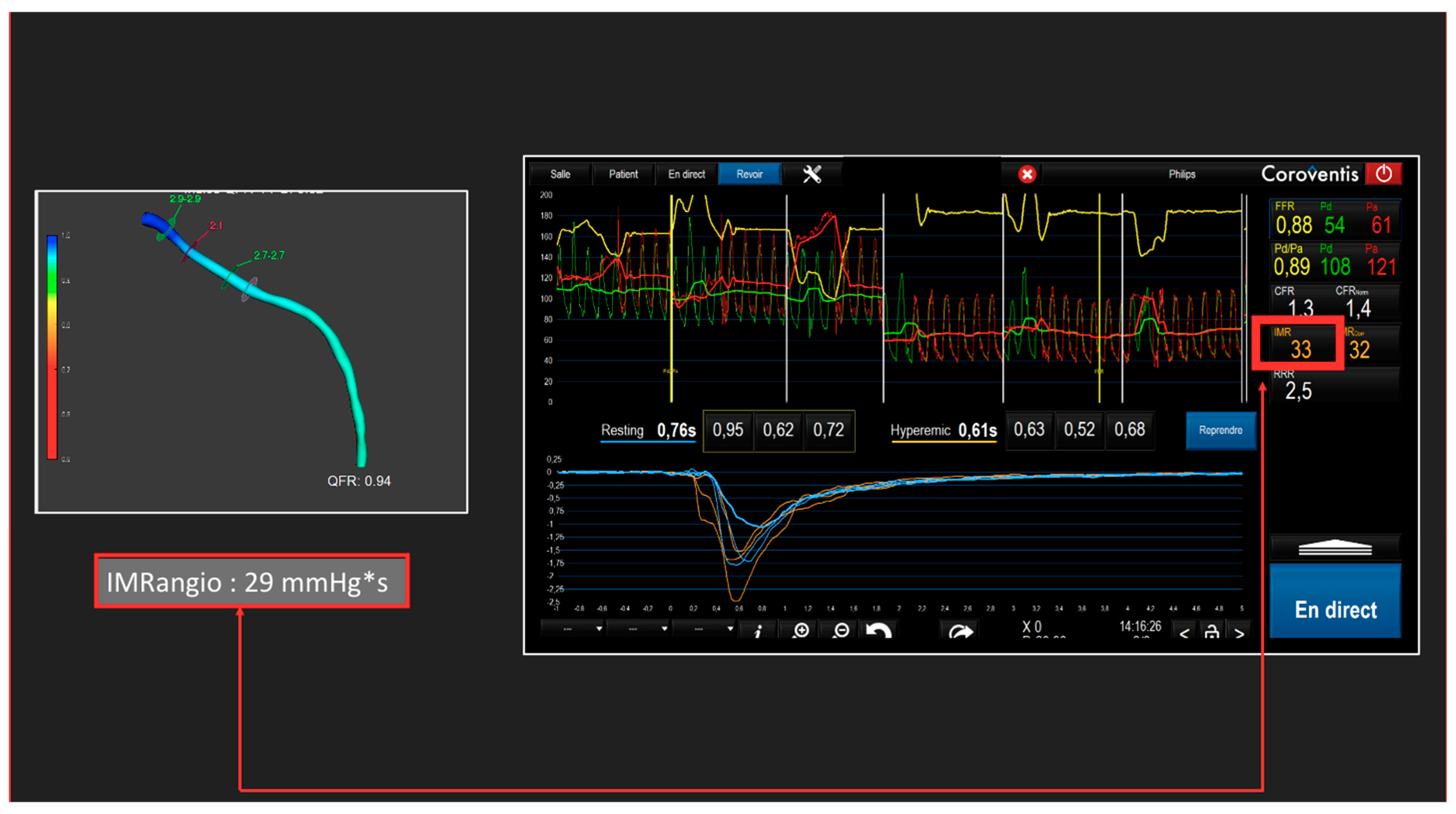 Diagnostics 13 01978 g005 Diagnostics 13 01978 g005