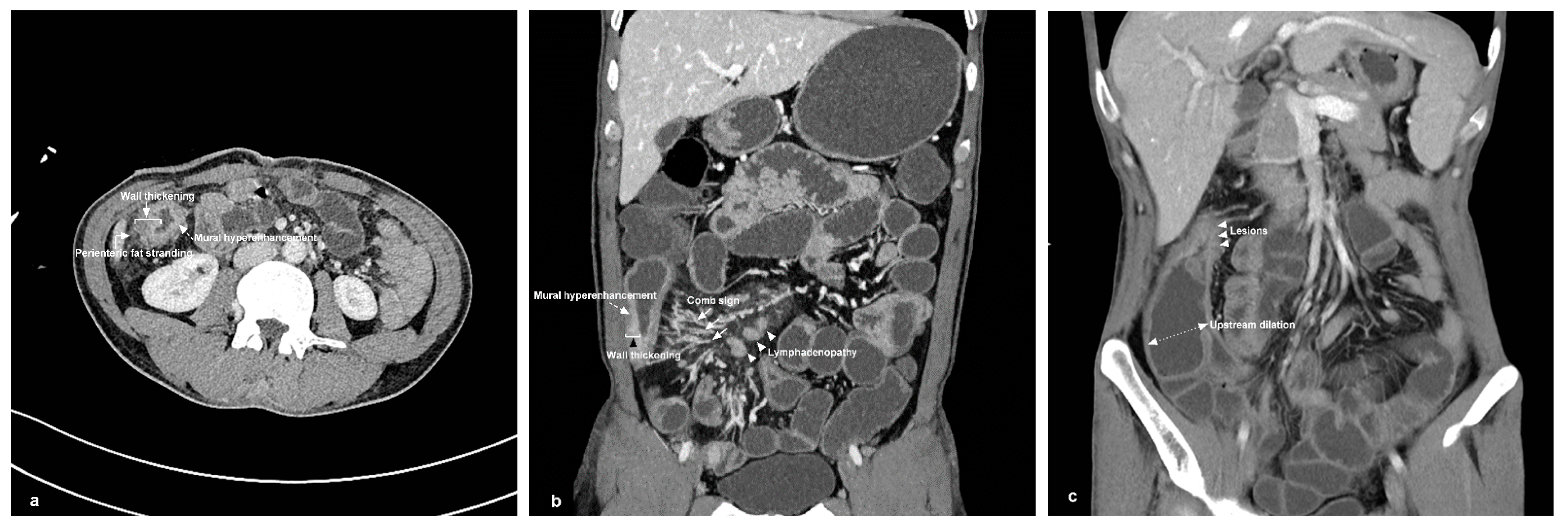 Diagnostics 13 01980 g002