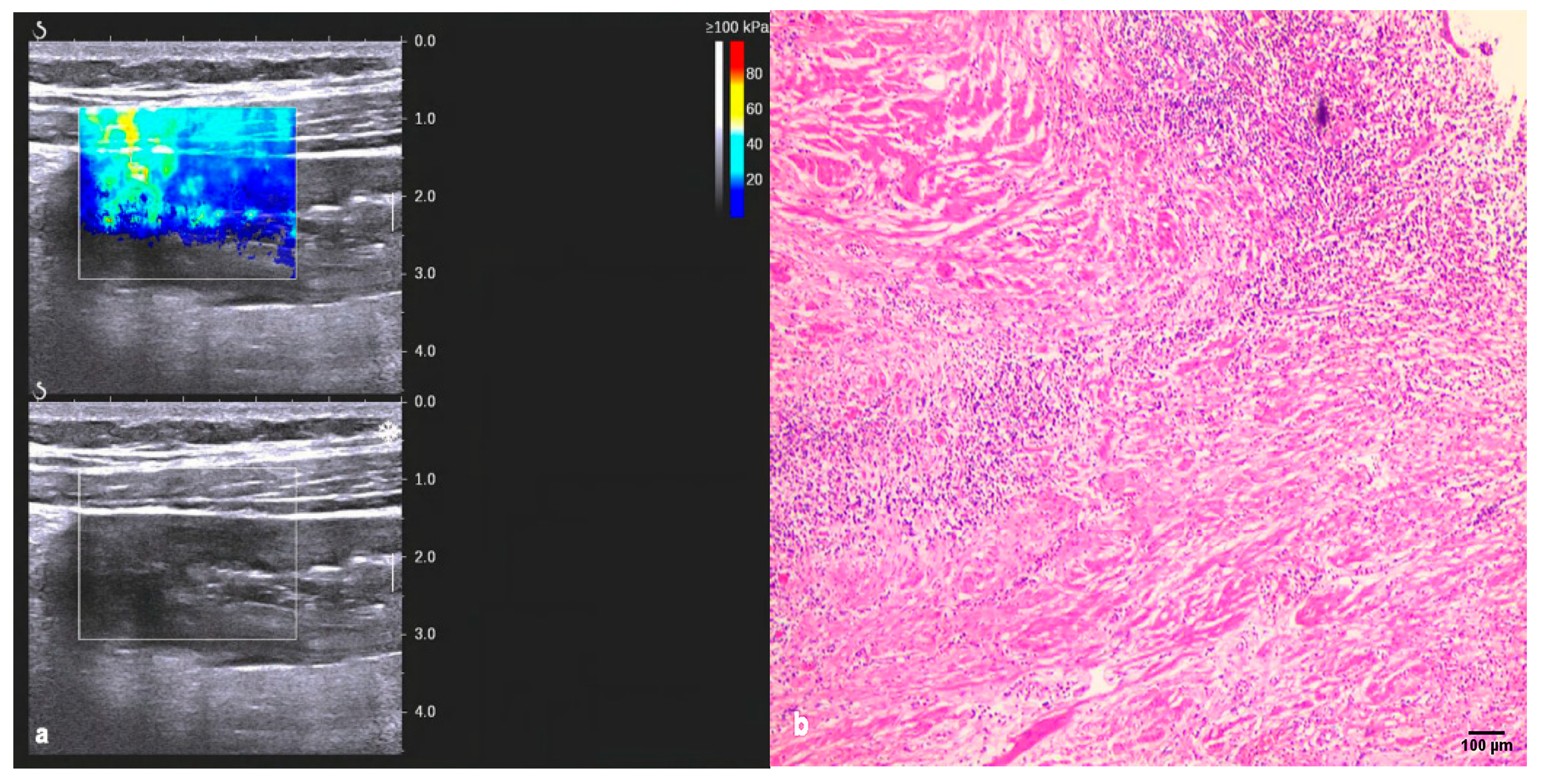 Diagnostics 13 01980 g003a