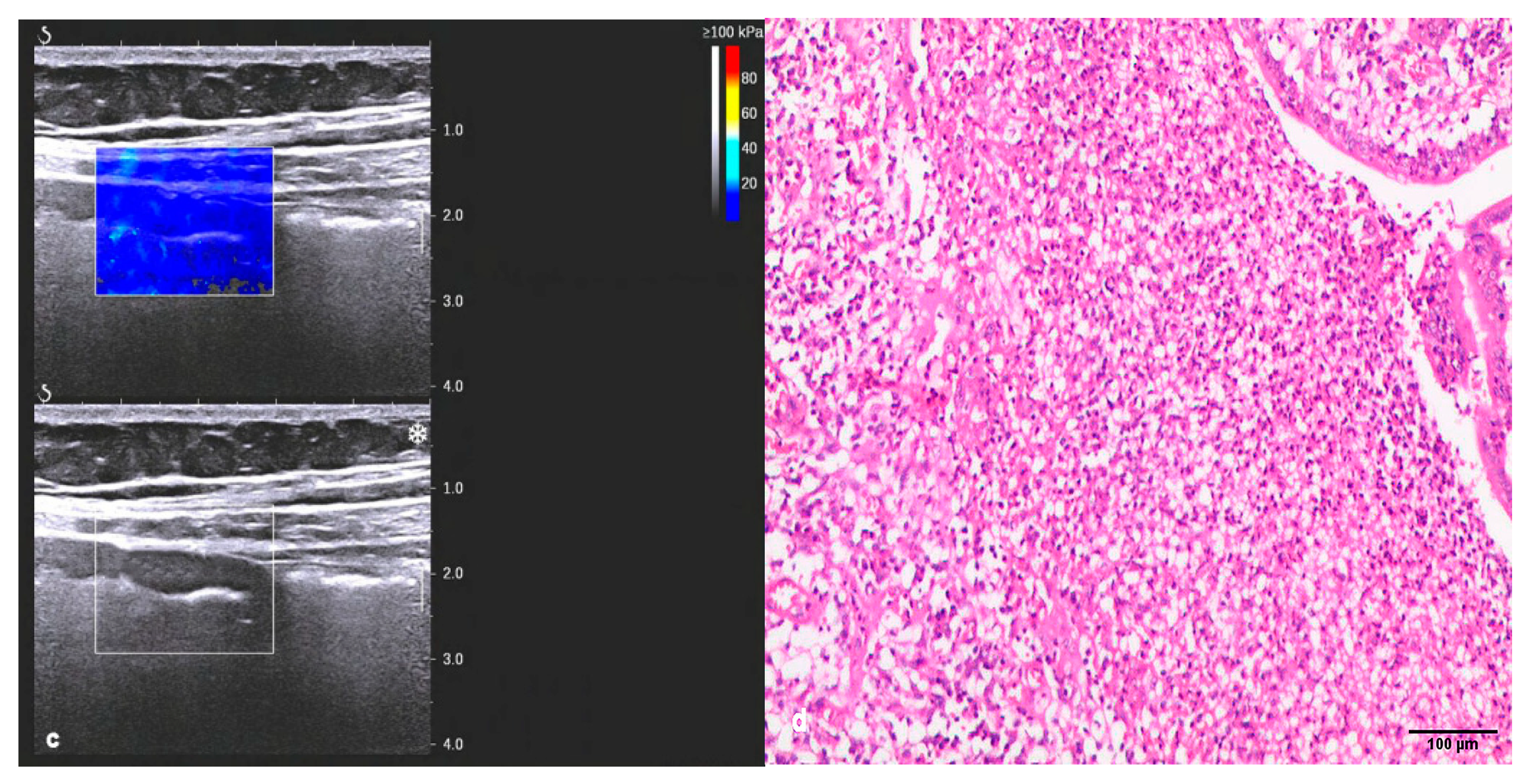 Diagnostics 13 01980 g003b