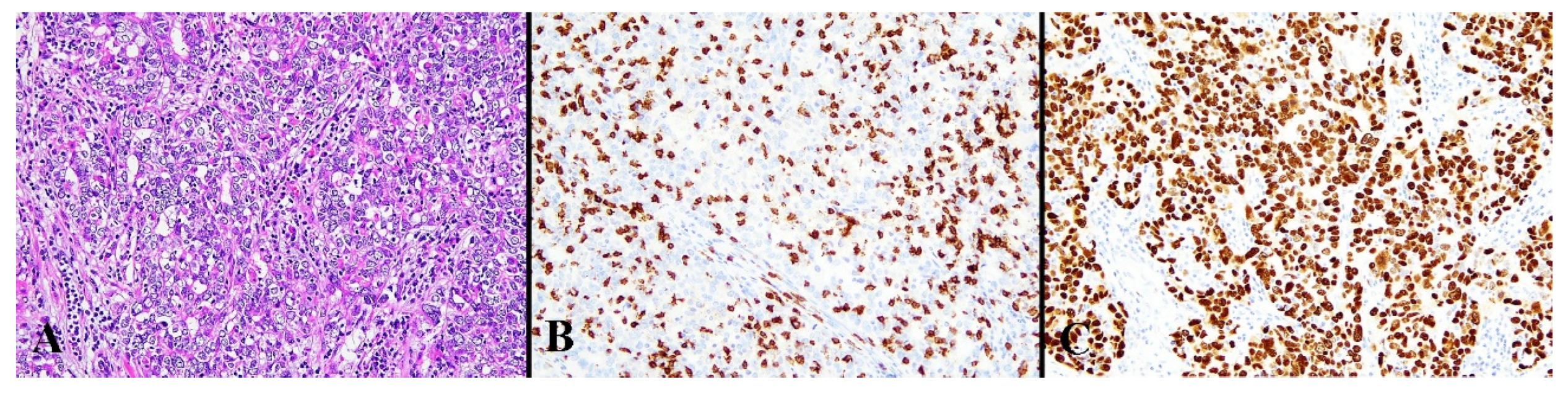 Diagnostics 13 01985 g004