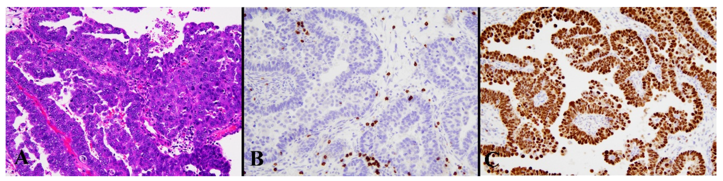 Diagnostics 13 01985 g005