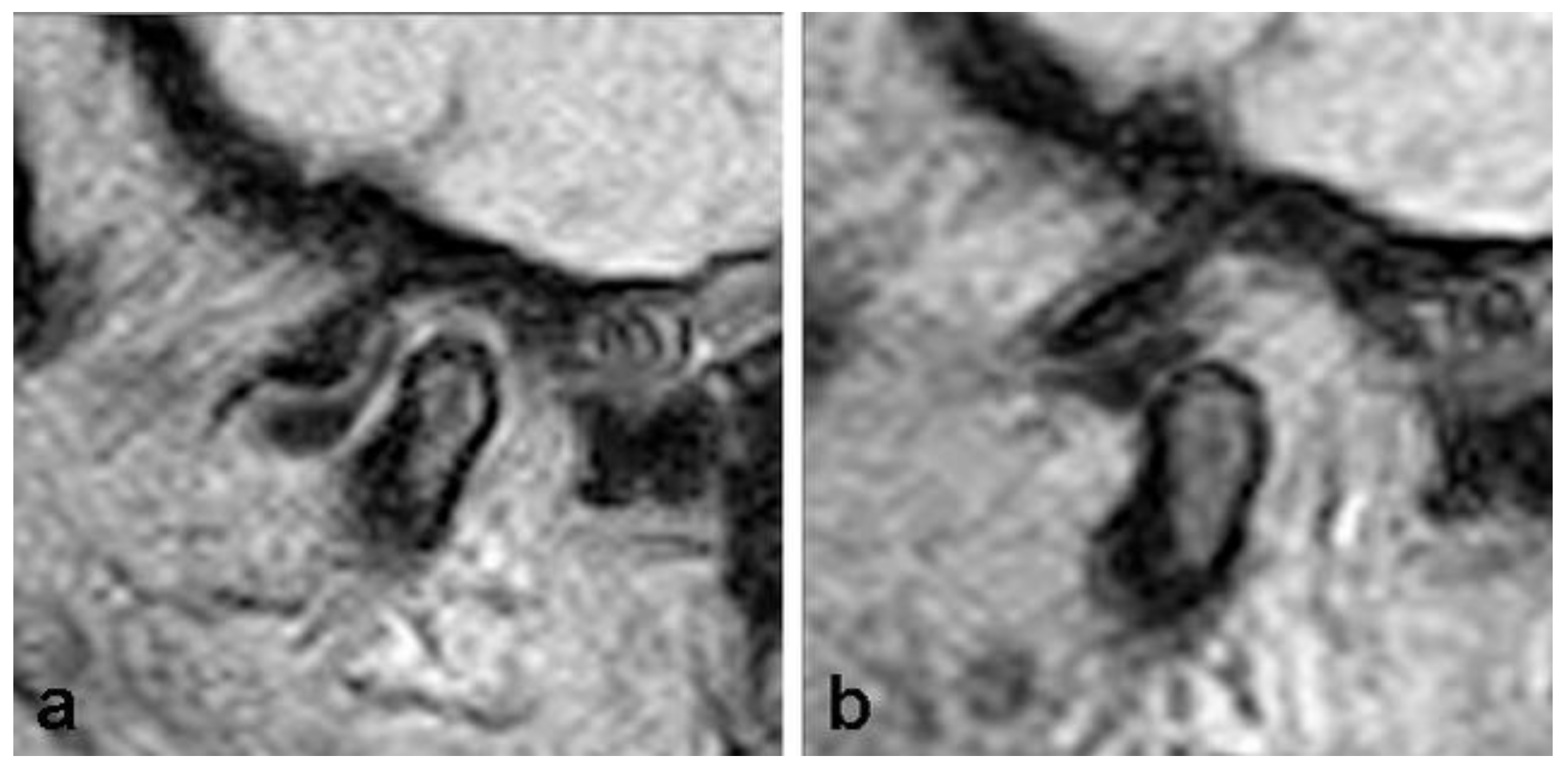 Diagnostics 13 01986 g002