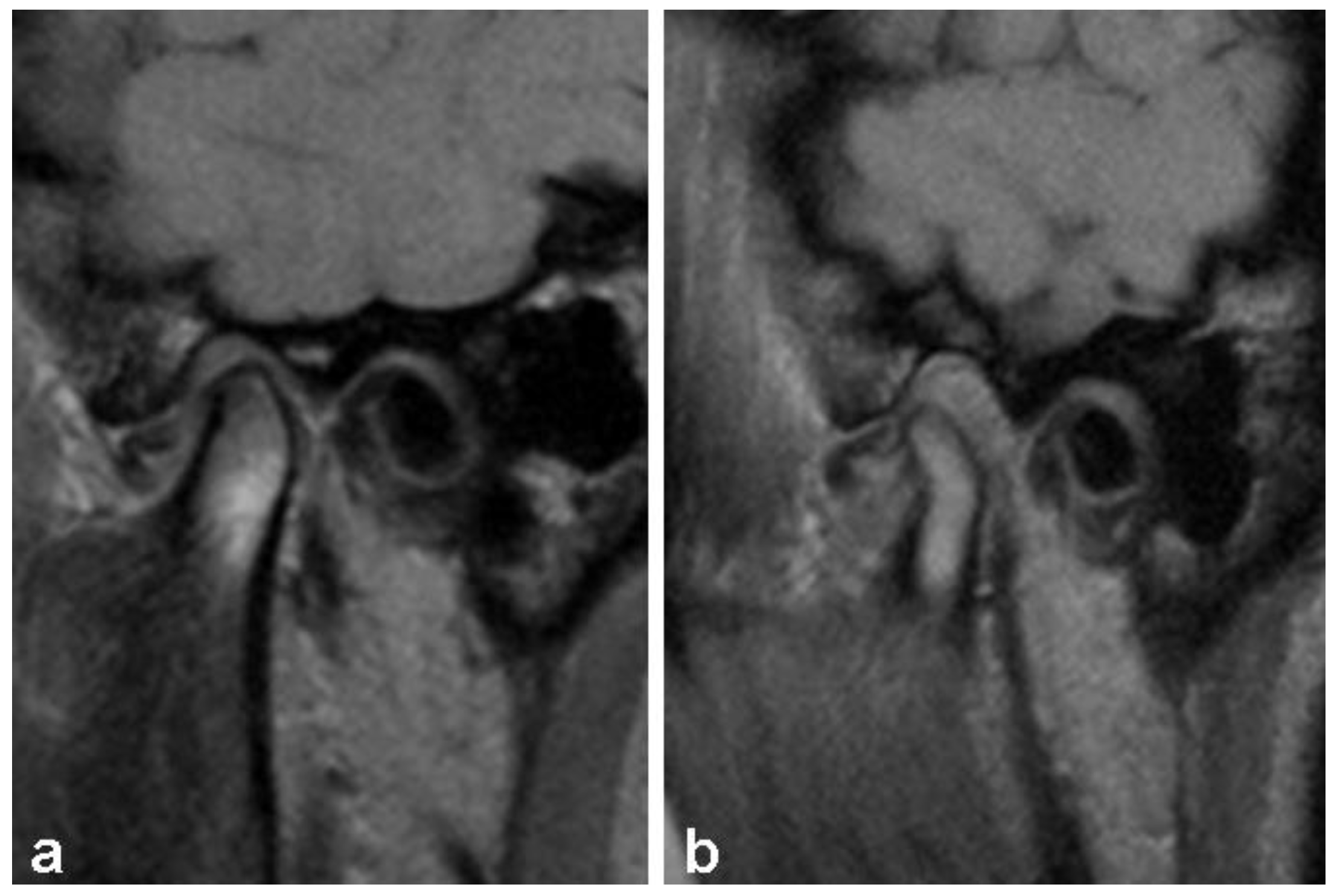 Diagnostics 13 01986 g003