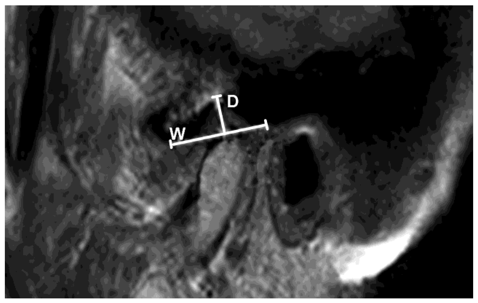 Diagnostics 13 01986 g006