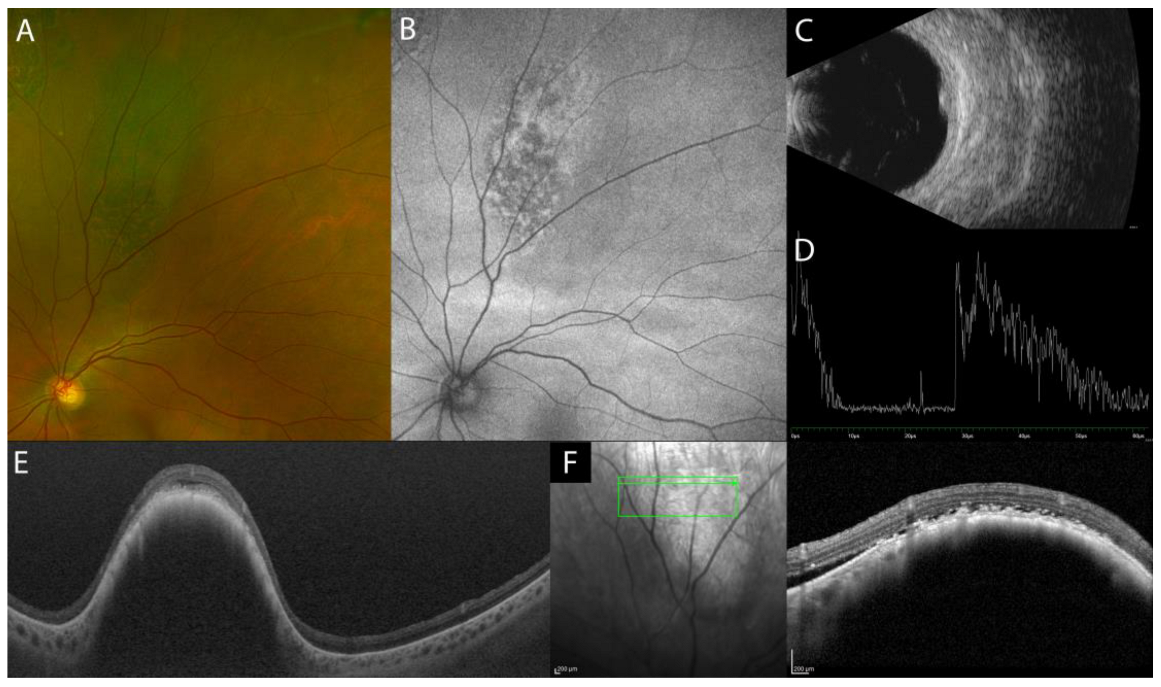 Diagnostics 13 01991 g005