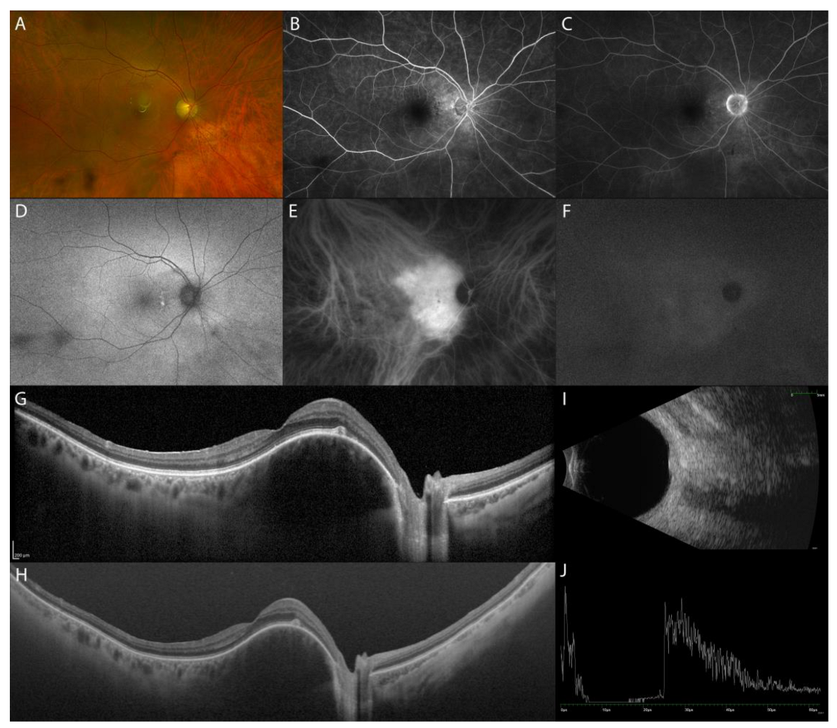 Diagnostics 13 01991 g007