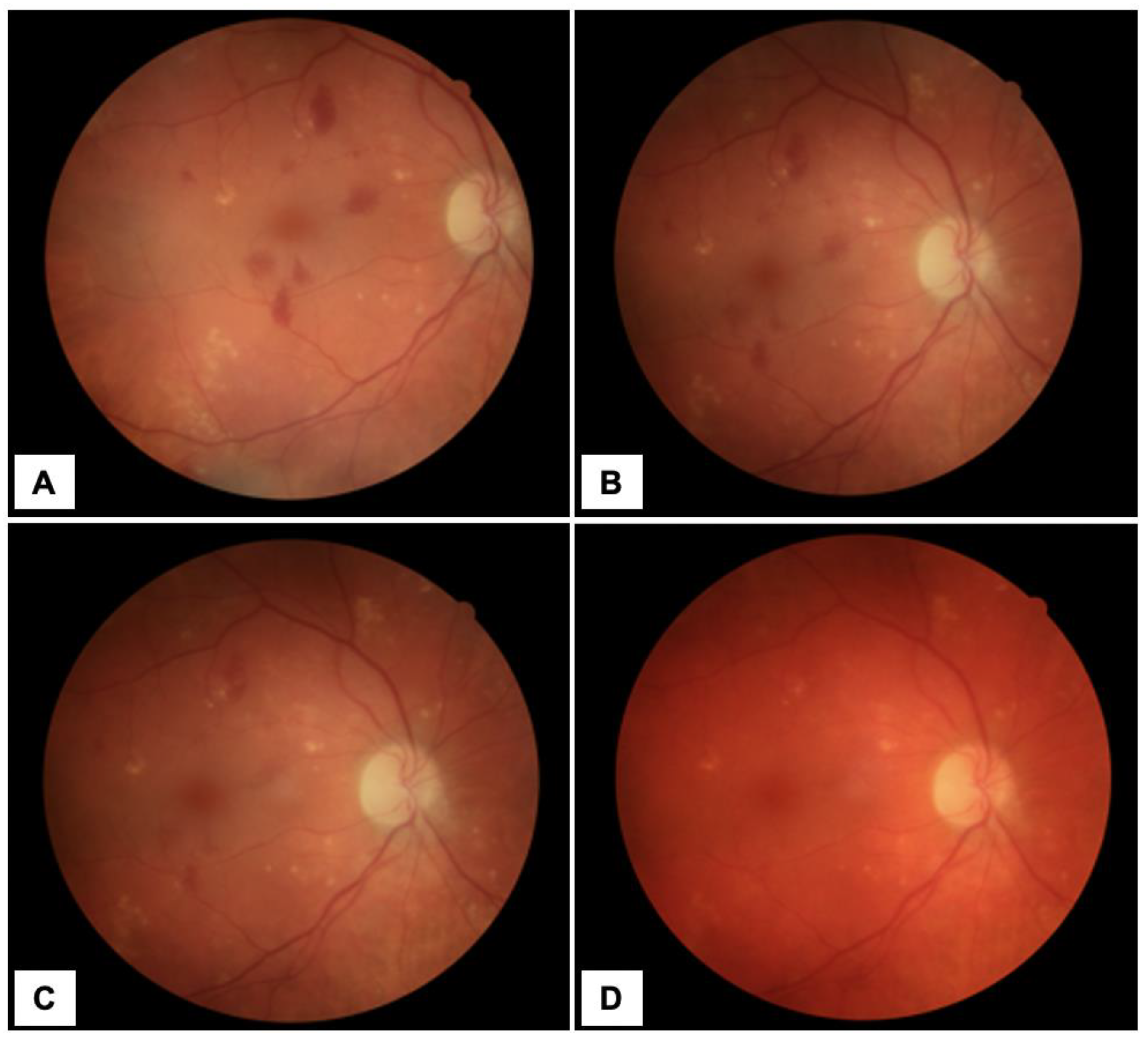 Diagnostics 13 01992 g001