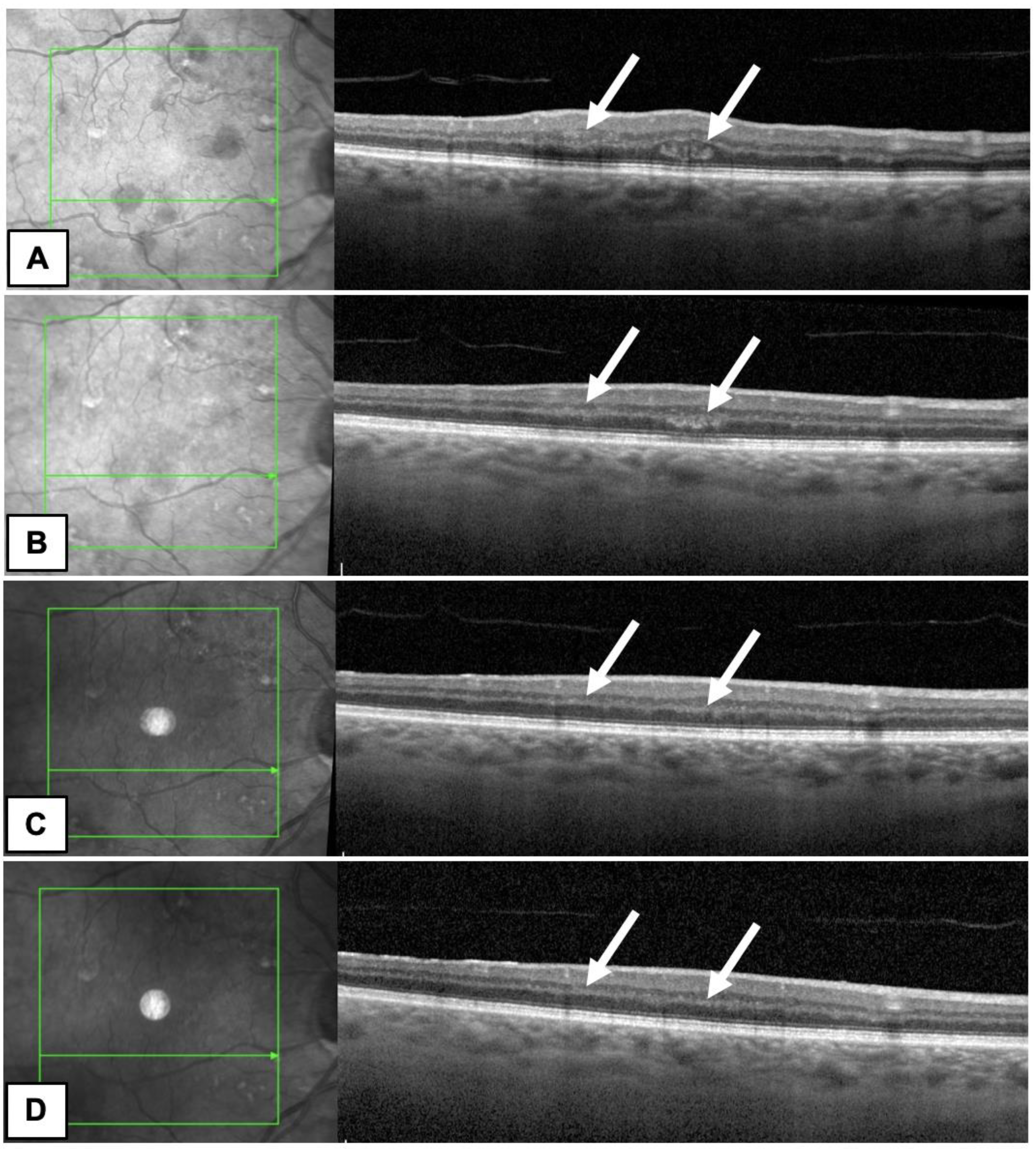 Diagnostics 13 01992 g002